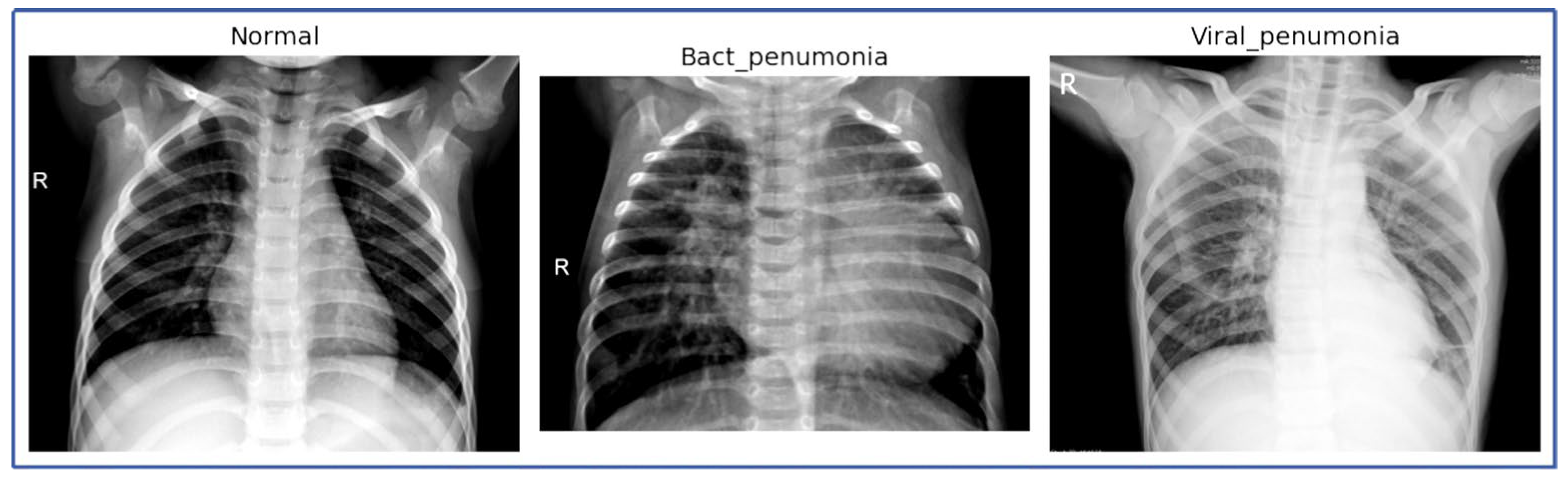 Jimaging 11 00022 g003