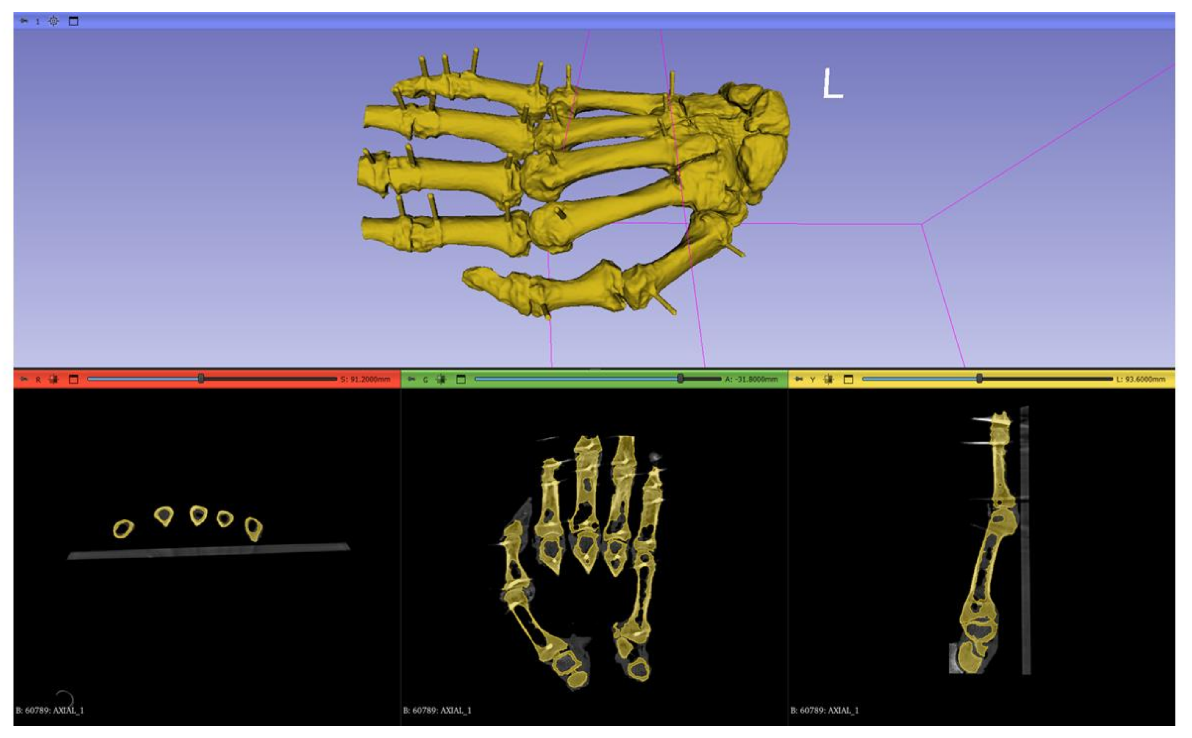 Jimaging 11 00039 g004