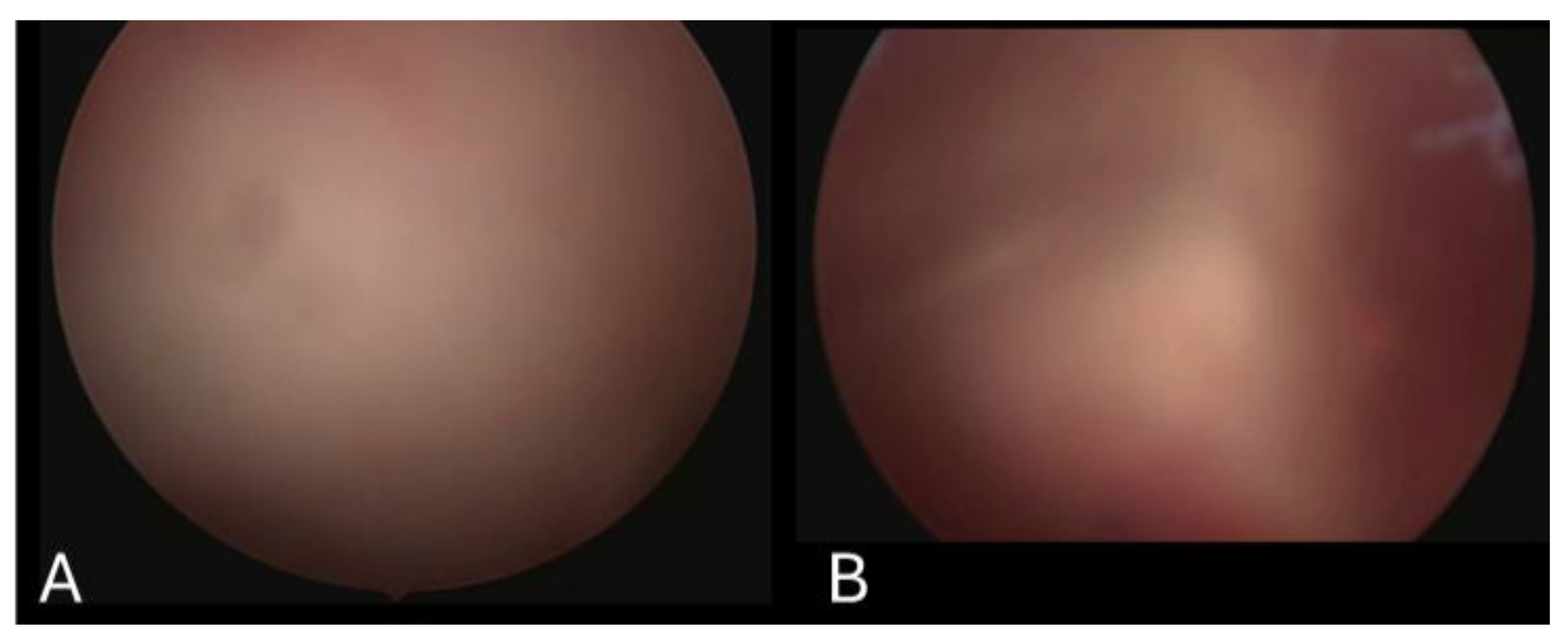 Jimaging 11 00040 g004