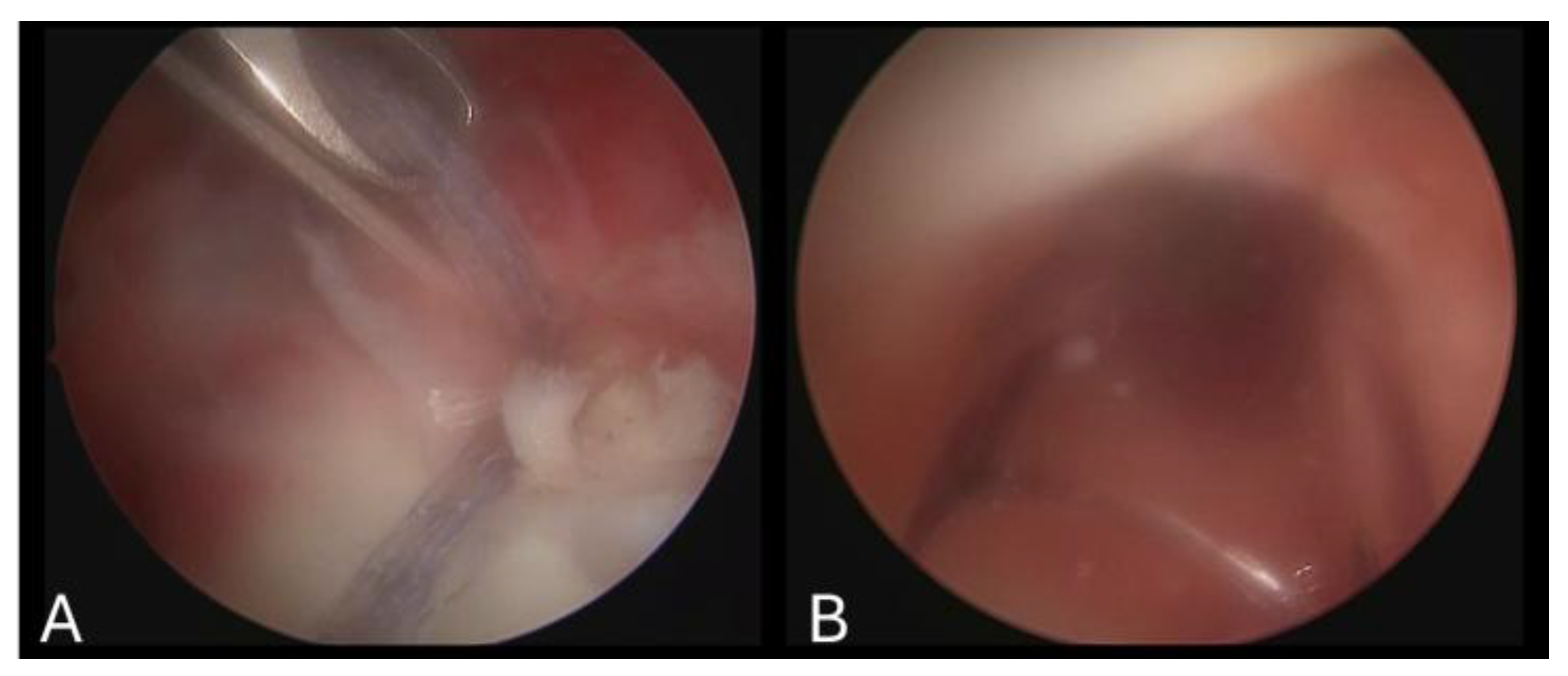 Jimaging 11 00040 g005