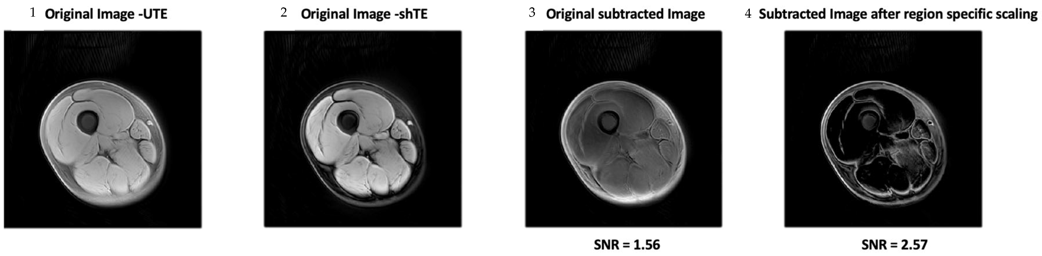 Jimaging 11 00043 g005