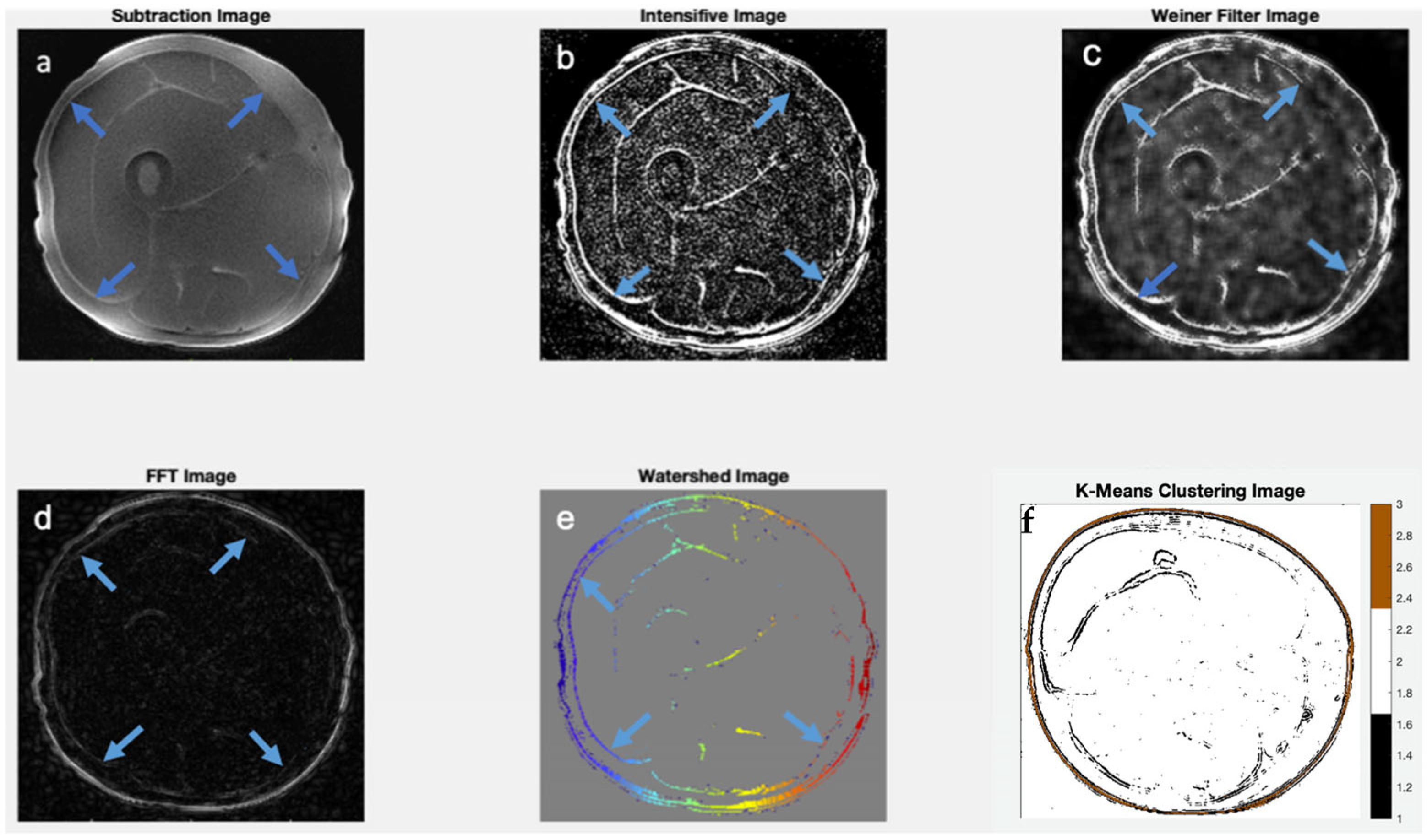 Jimaging 11 00043 g006