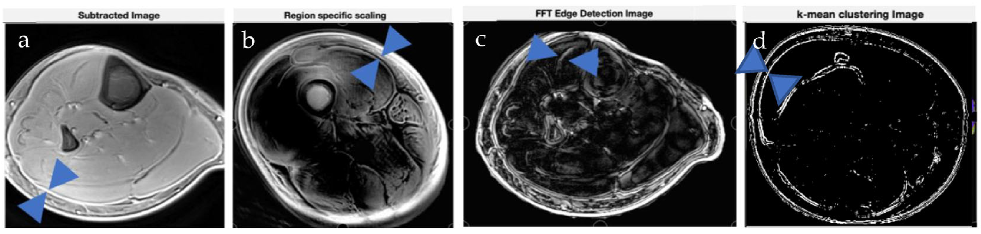 Jimaging 11 00043 g007