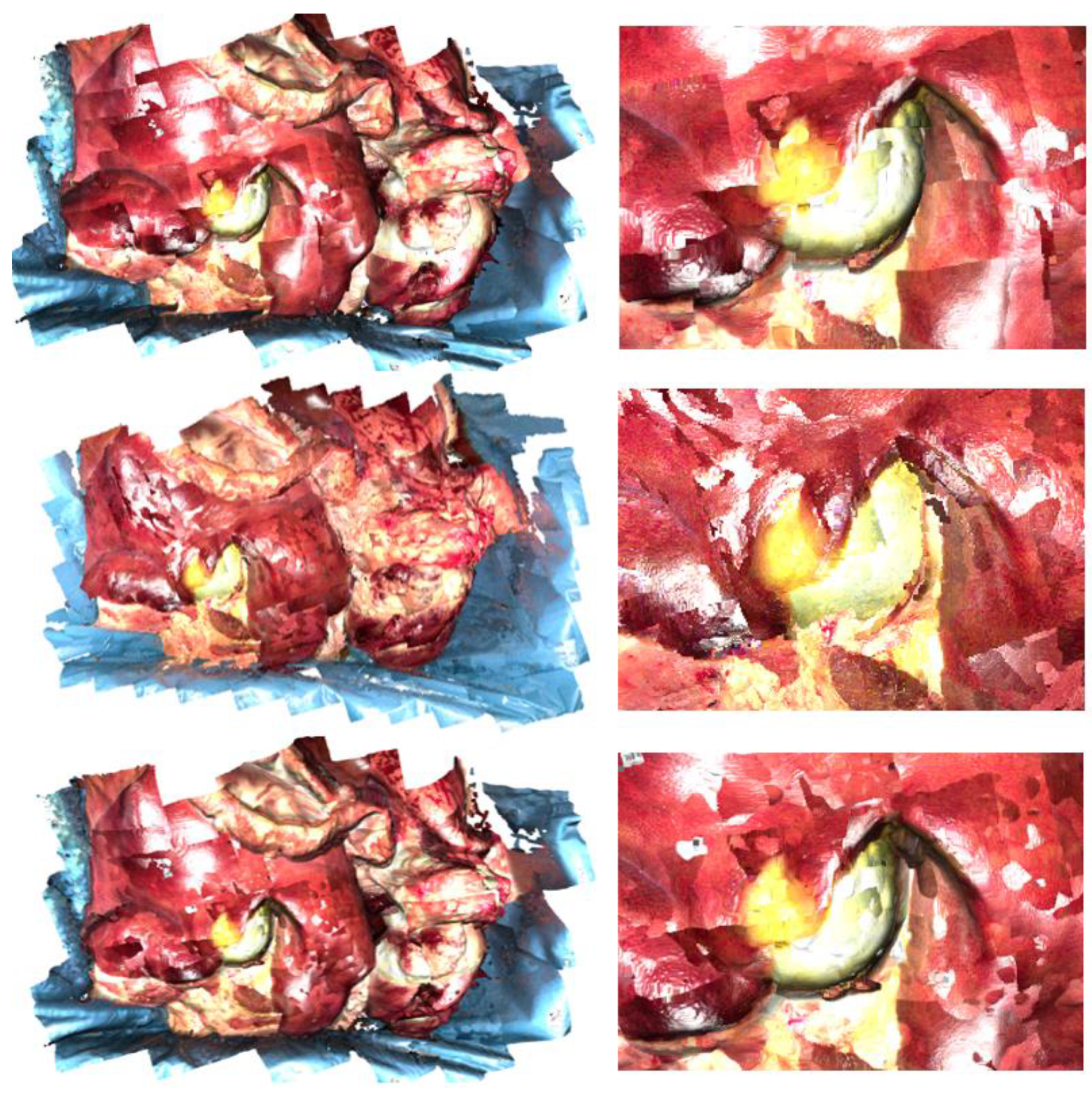 Jimaging 11 00044 g007