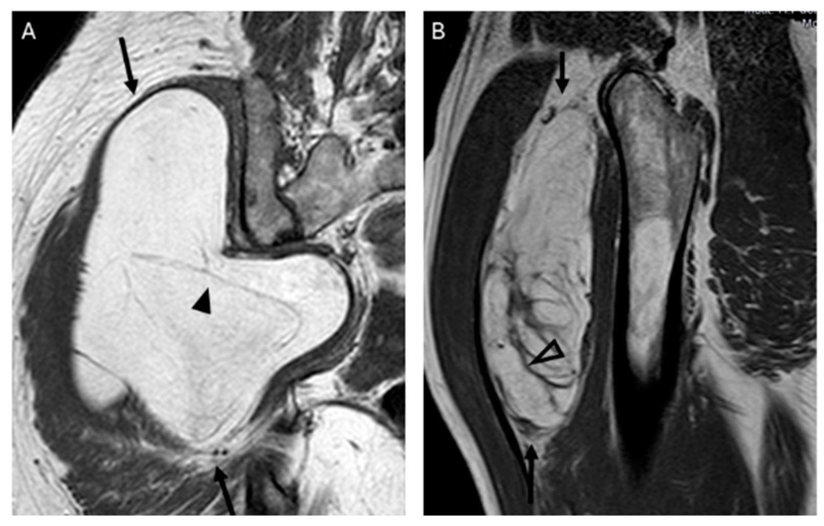 Jimaging 11 00047 g005