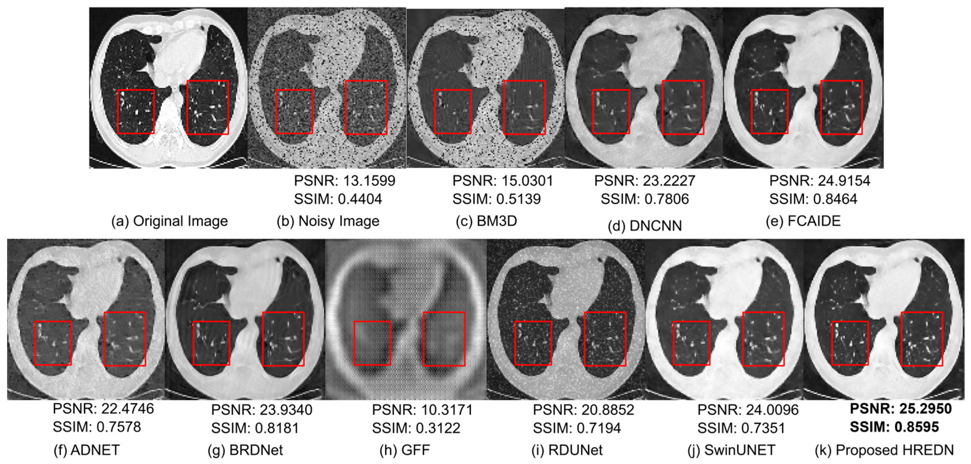 Jimaging 11 00051 g007