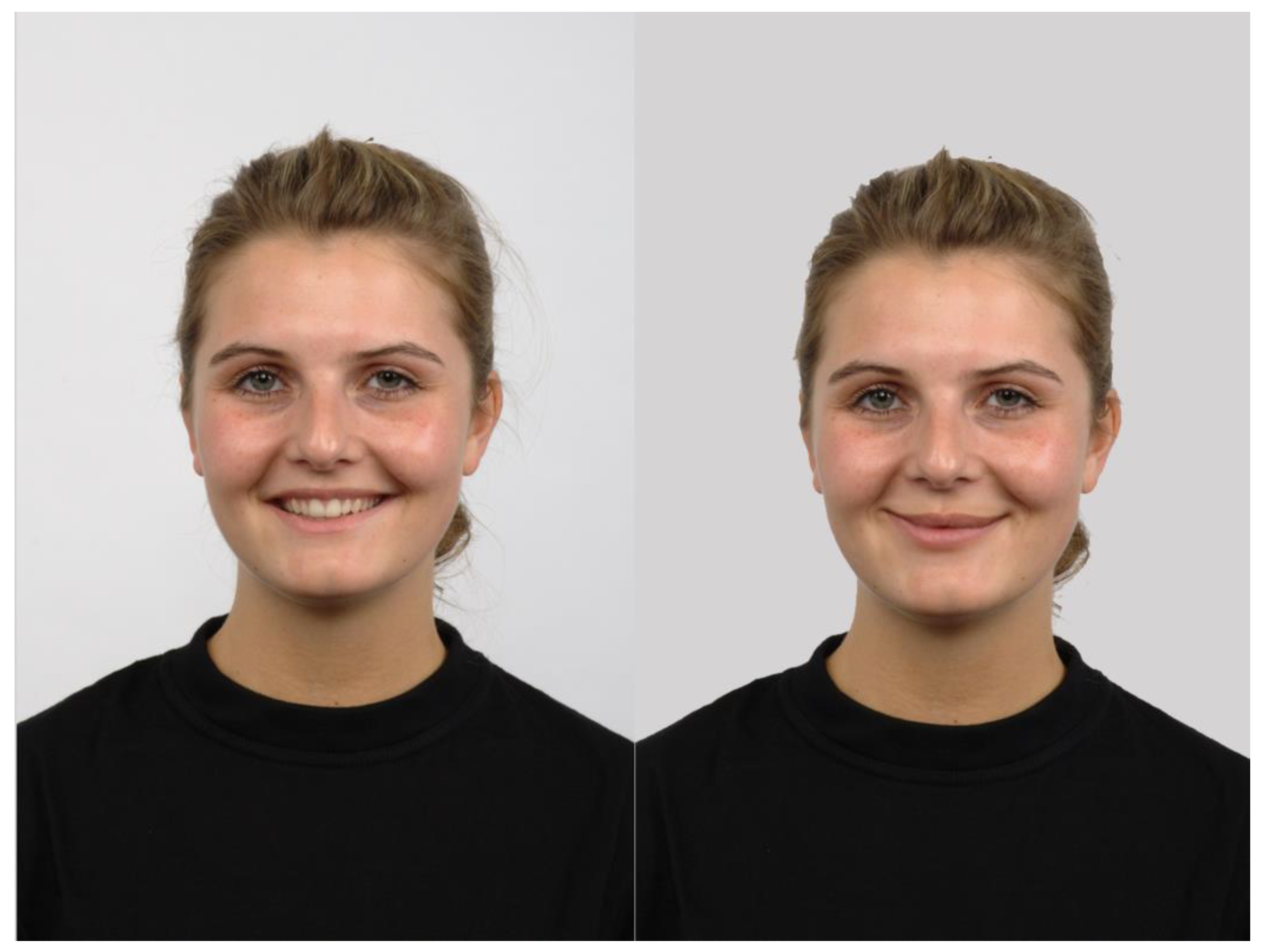 Jimaging 11 00060 g001