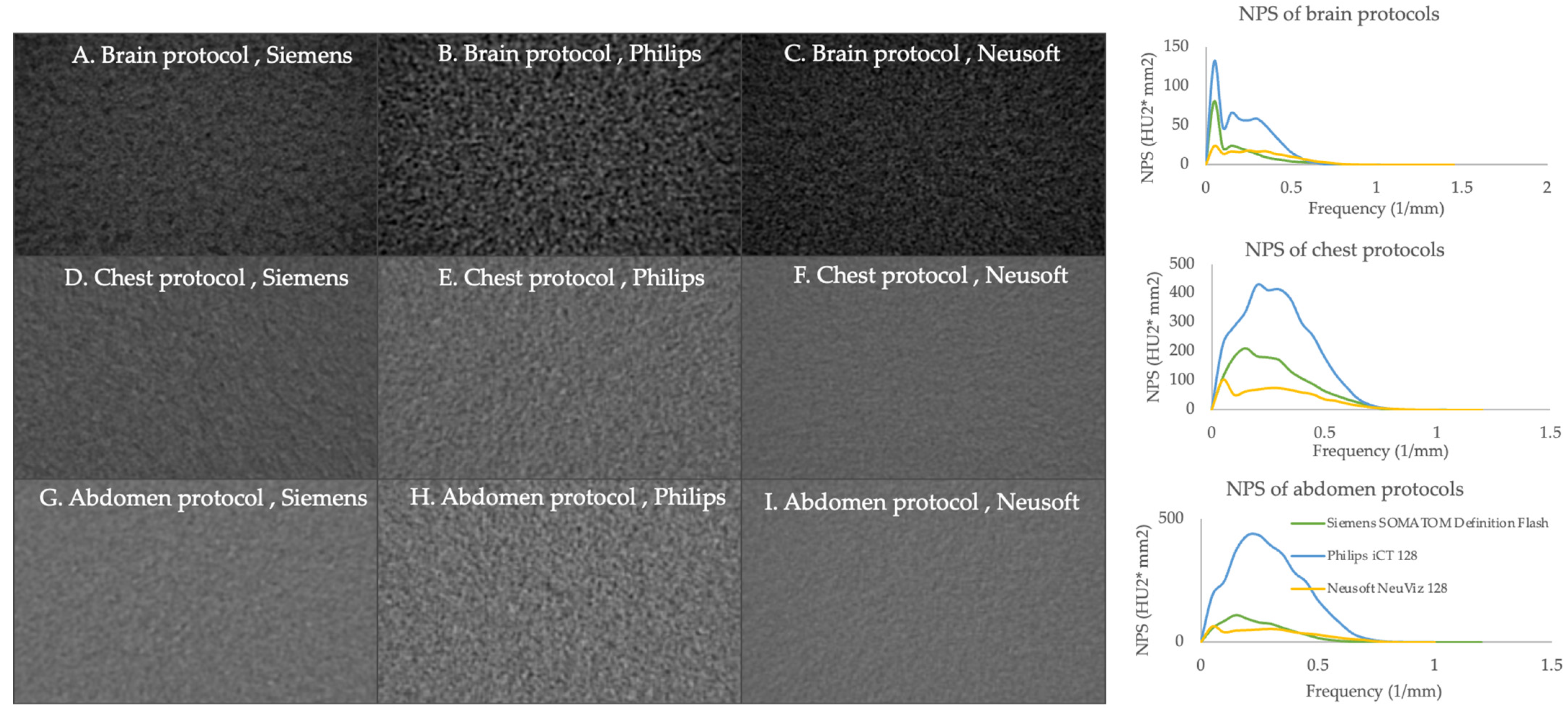 Jimaging 11 00070 g005