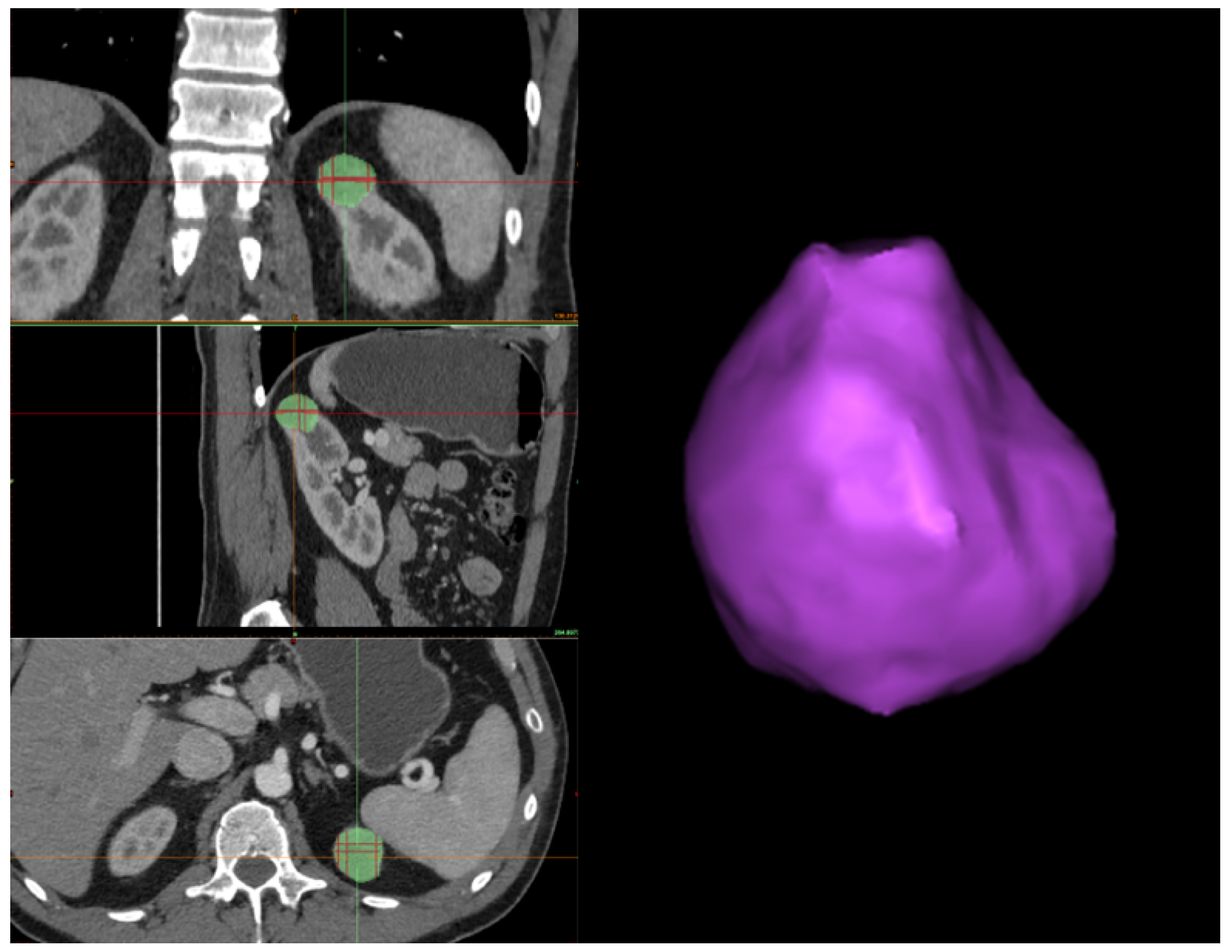 Jimaging 11 00078 g004