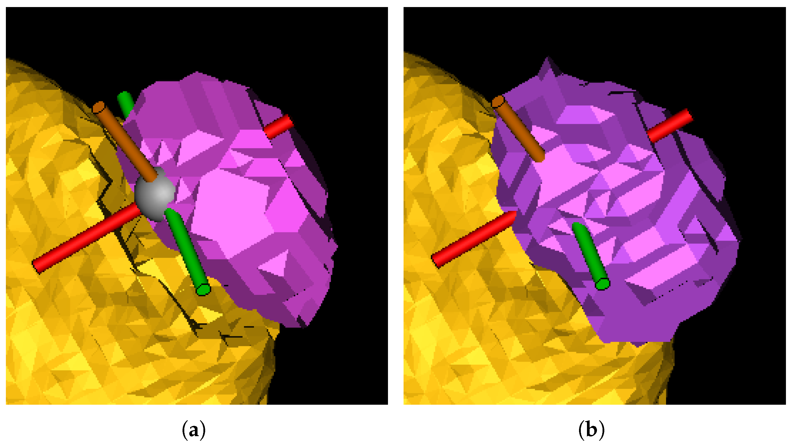 Jimaging 11 00078 g005
