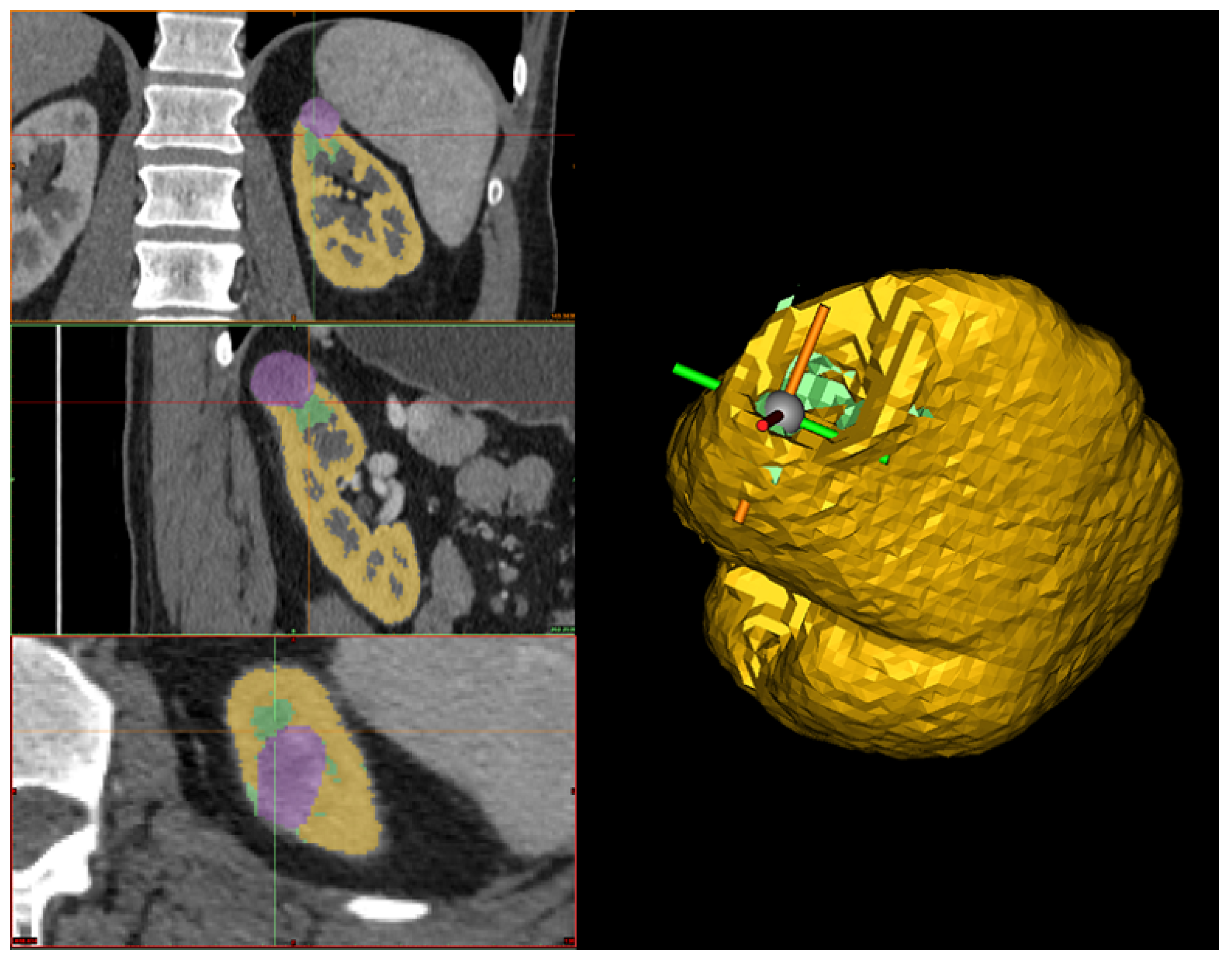 Jimaging 11 00078 g006