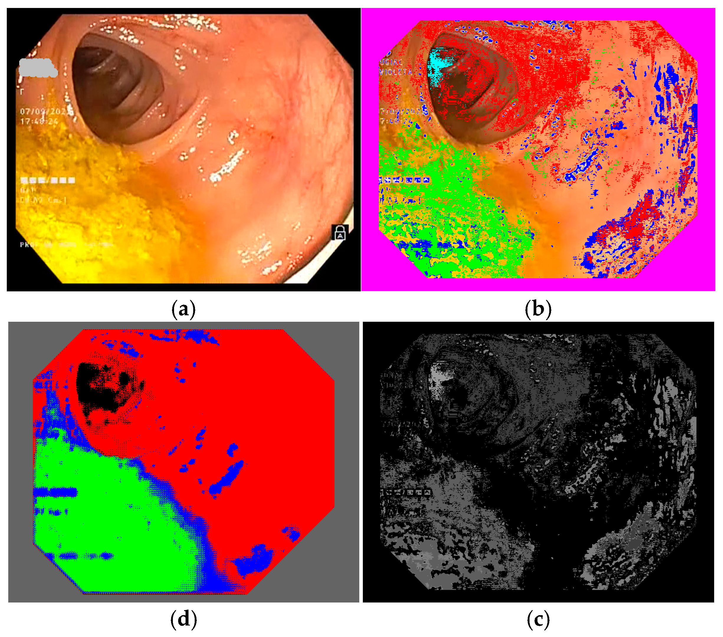 Jimaging 11 00084 g004