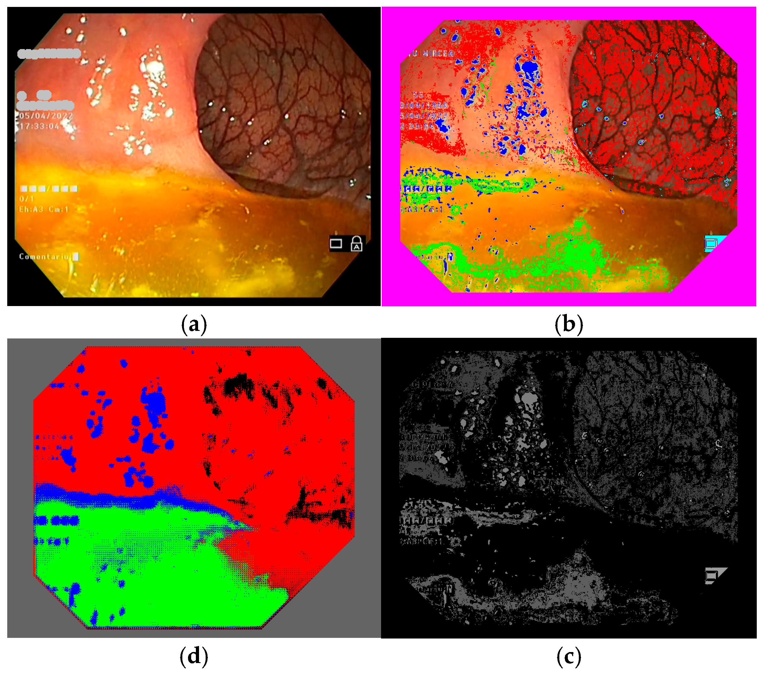 Jimaging 11 00084 g005