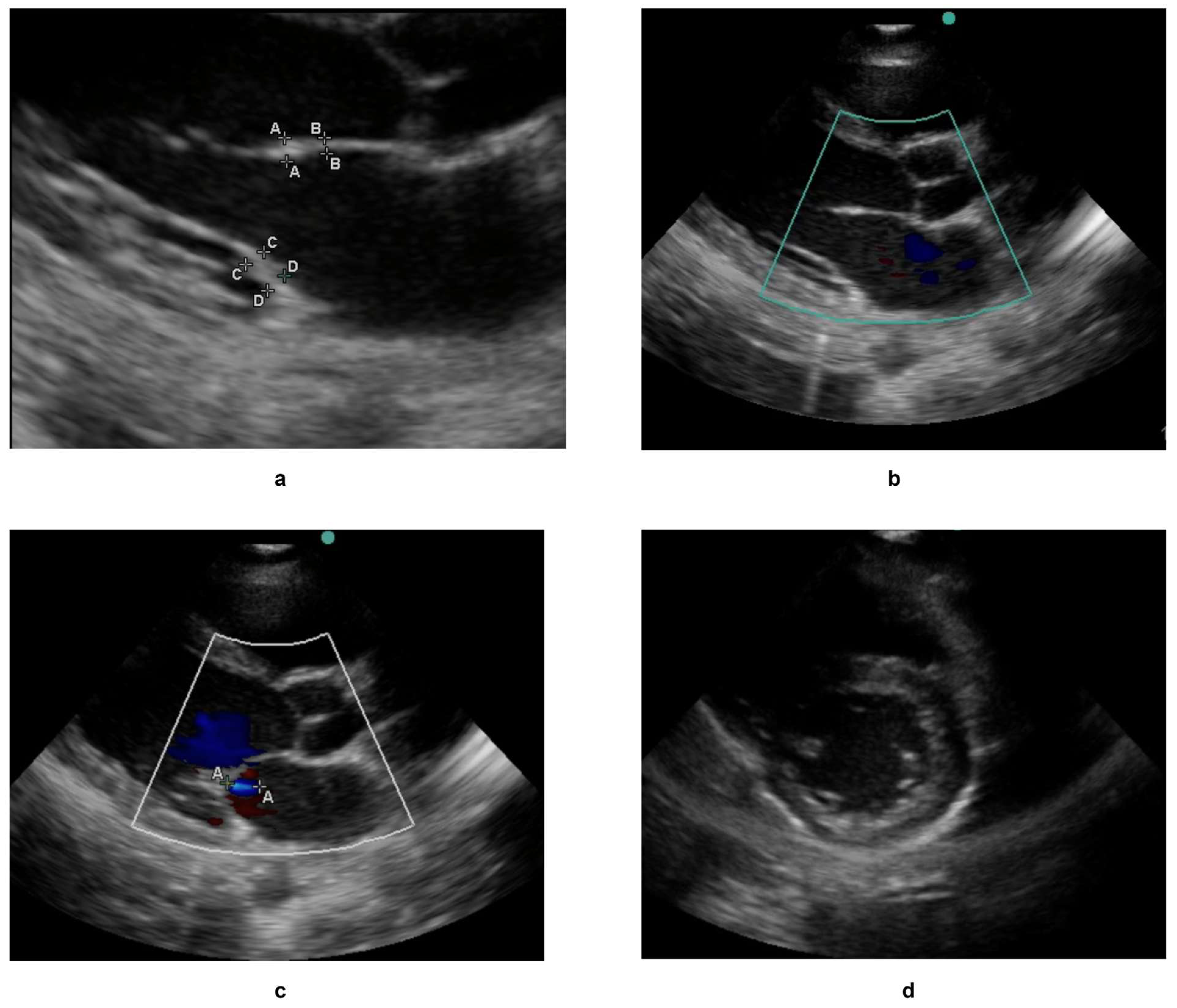 Jimaging 11 00097 g004