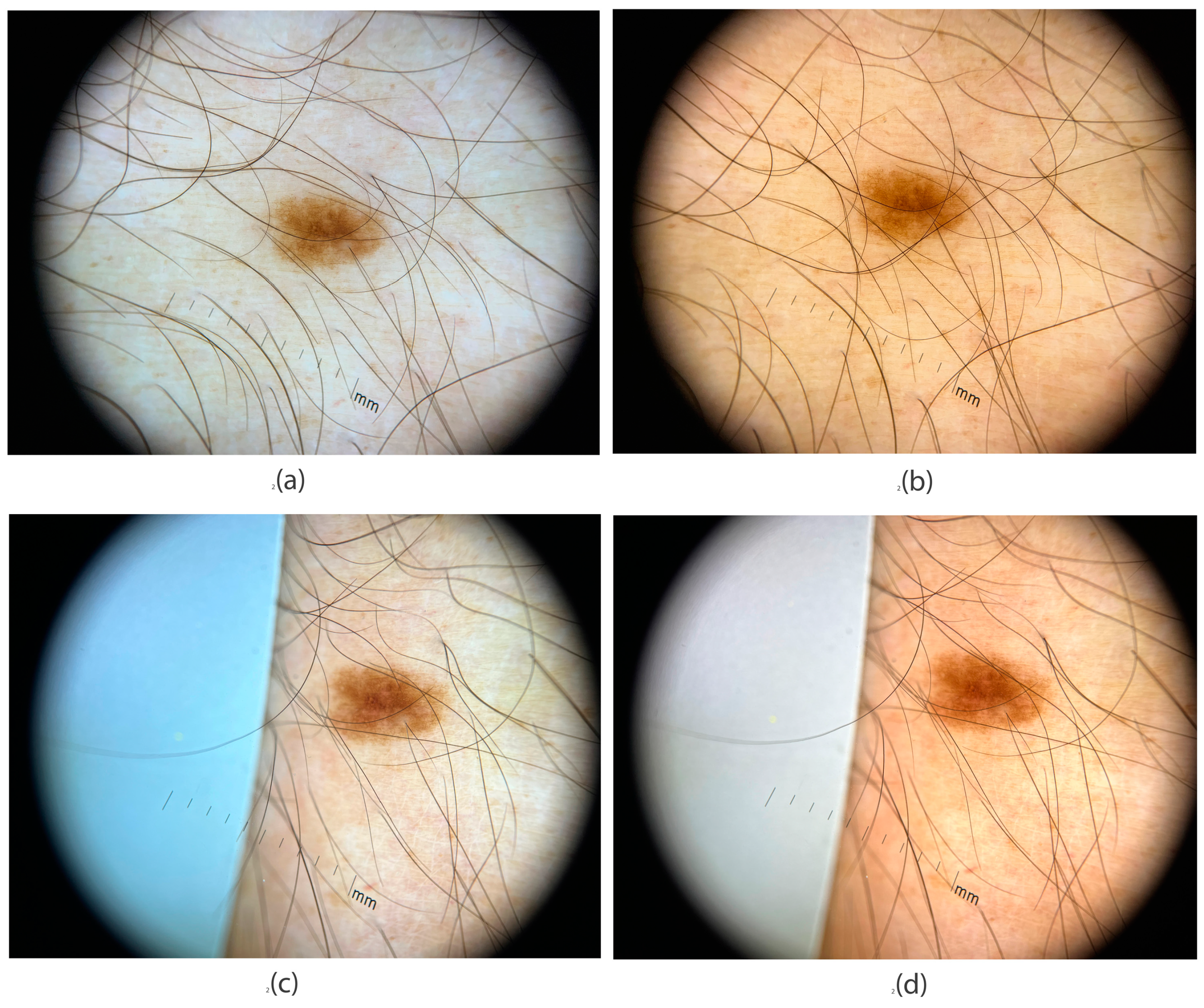 Jimaging 11 00107 g009 Jimaging 11 00107 g009