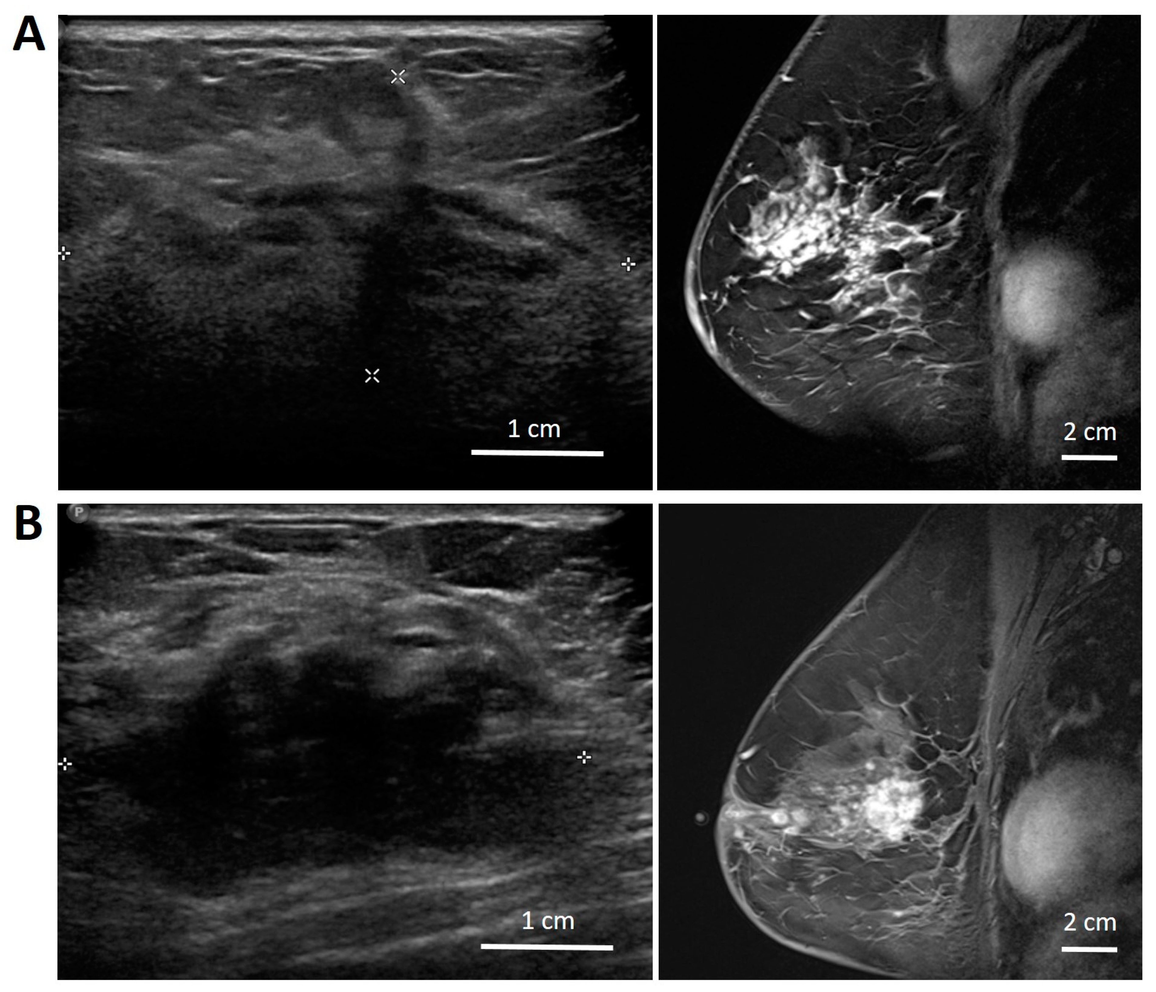 Jimaging 11 00109 g004