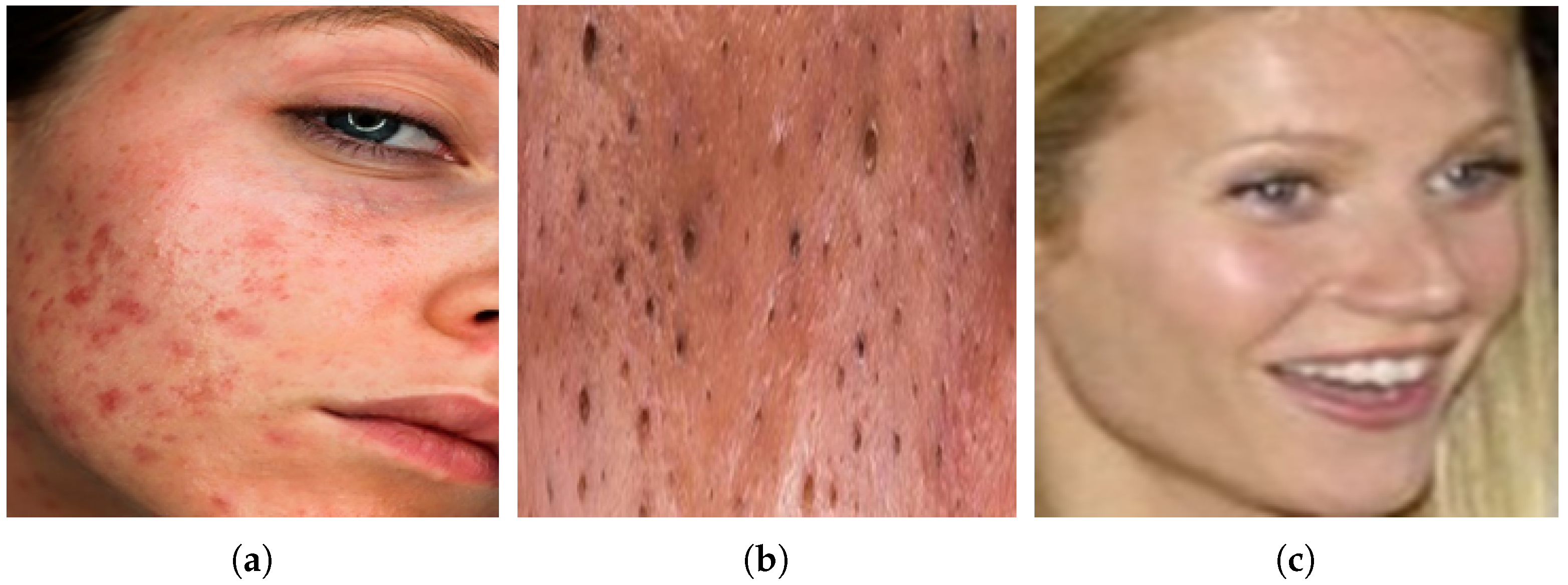 Jimaging 11 00115 g002