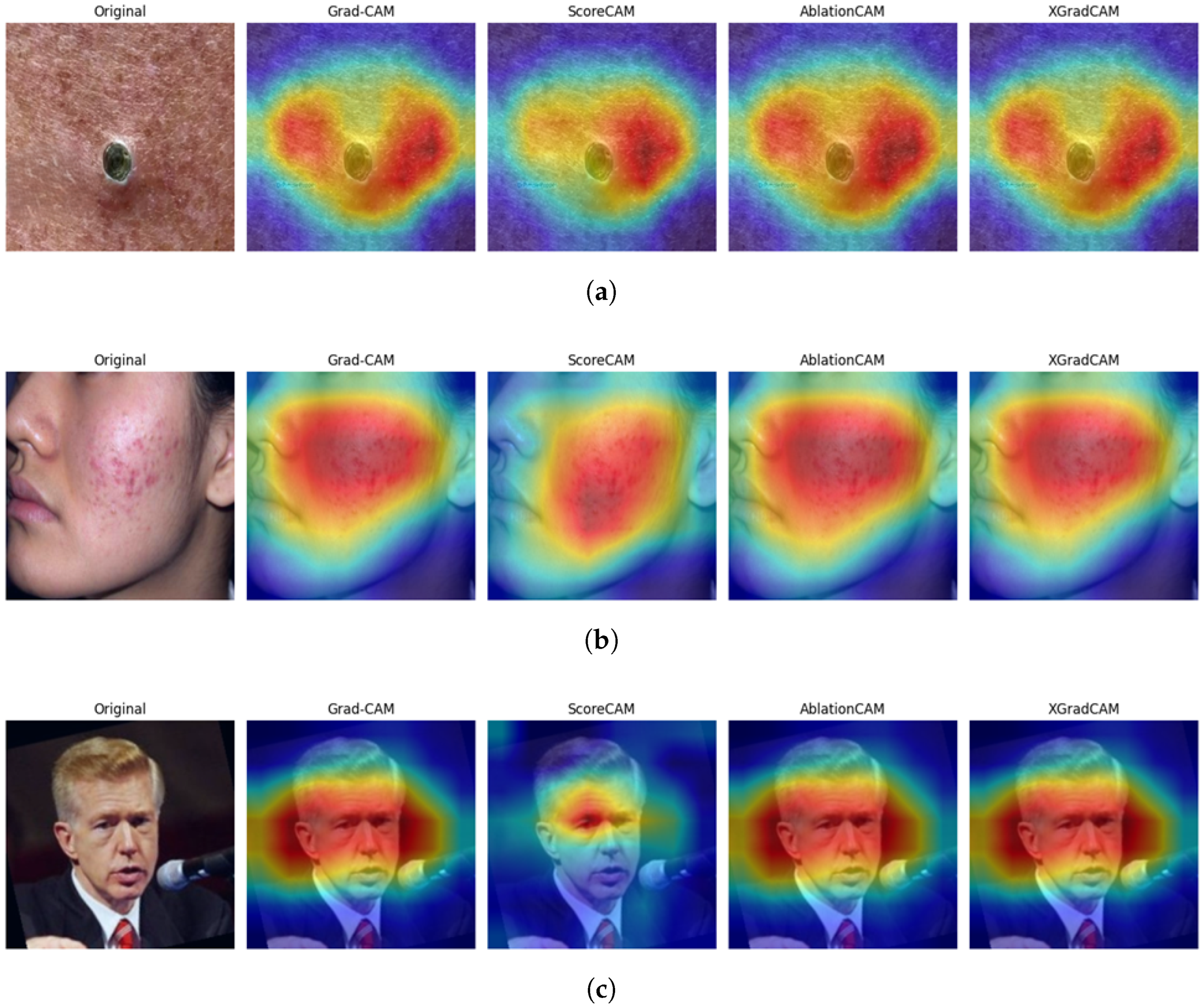 Jimaging 11 00115 g008