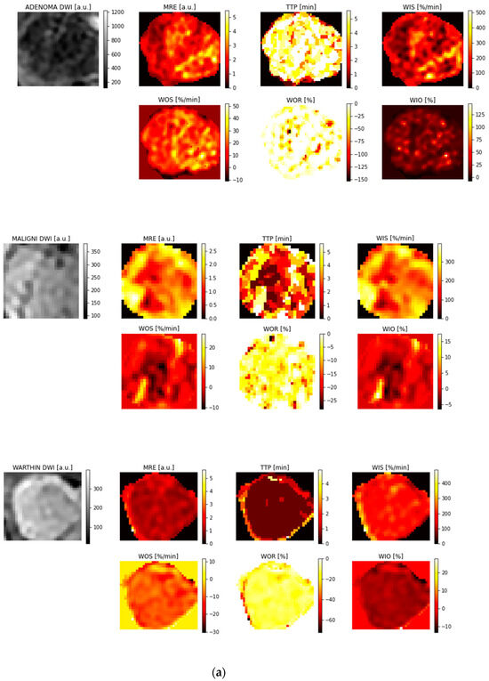 Jimaging 11 00122 g003a