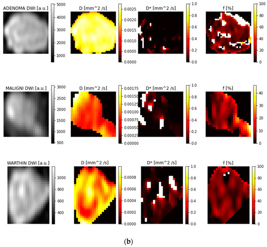 Jimaging 11 00122 g003b