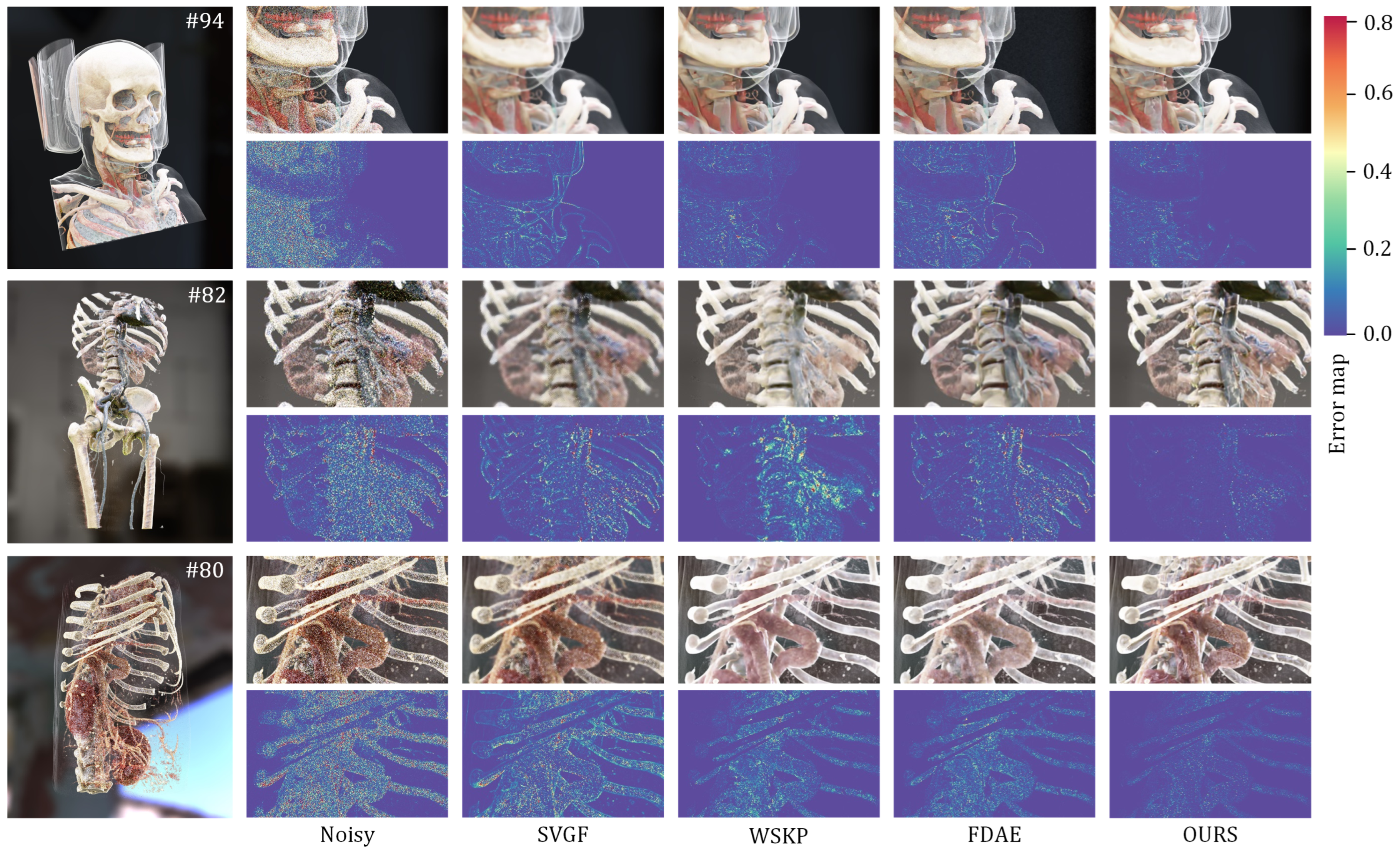 Jimaging 11 00126 g008