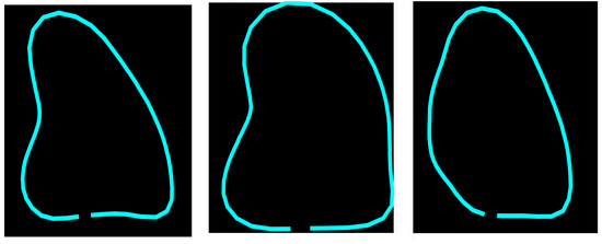 Jimaging 11 00165 g003