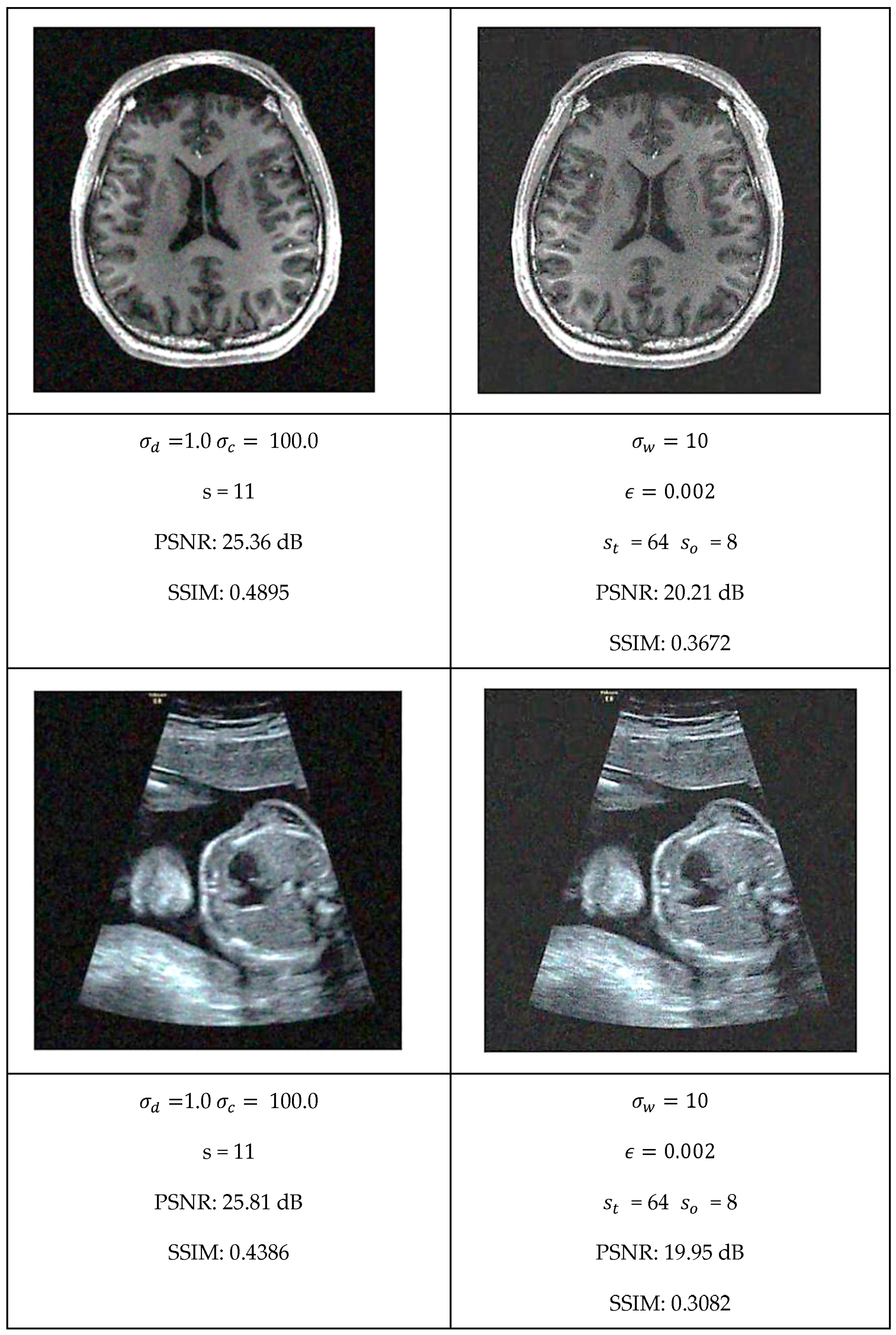 Jimaging 11 00167 g010c