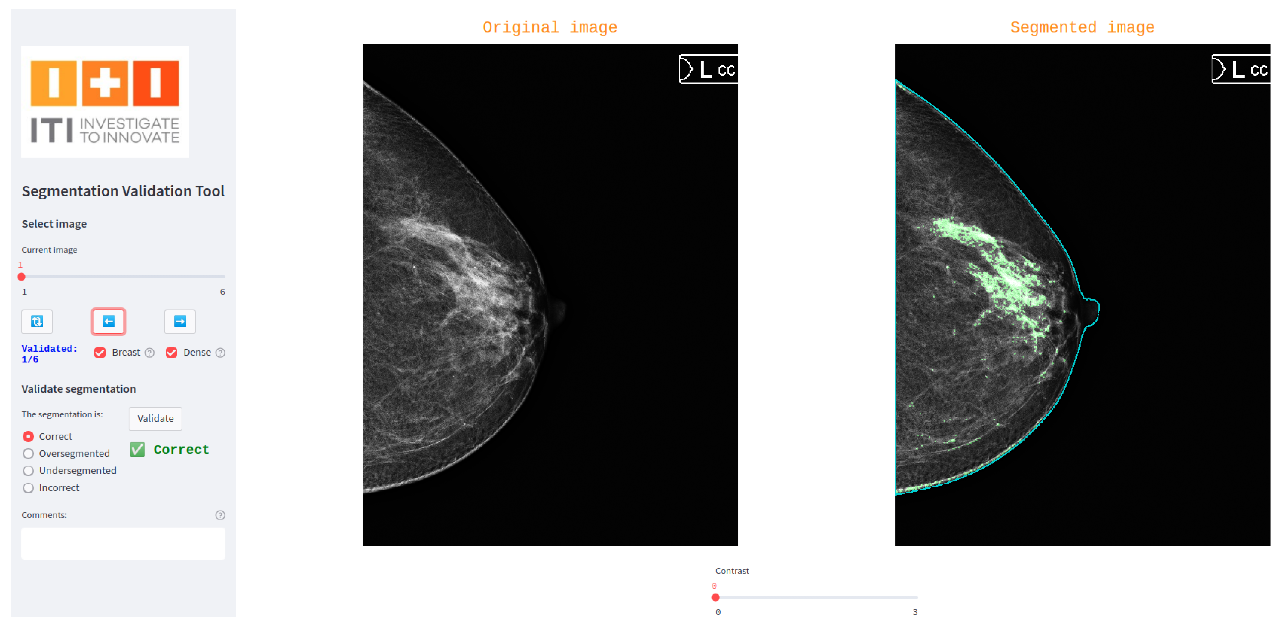 Jimaging 11 00170 g002