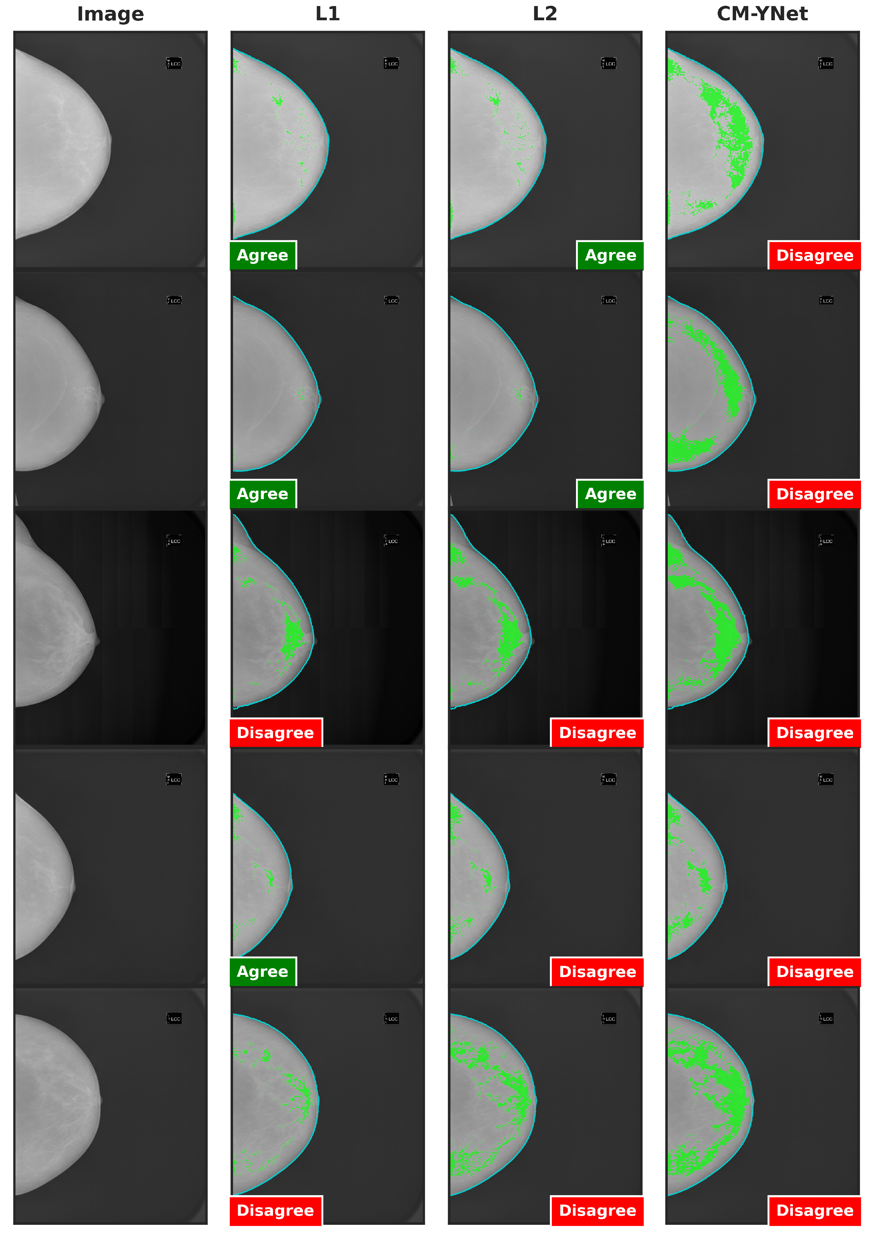 Jimaging 11 00170 g015