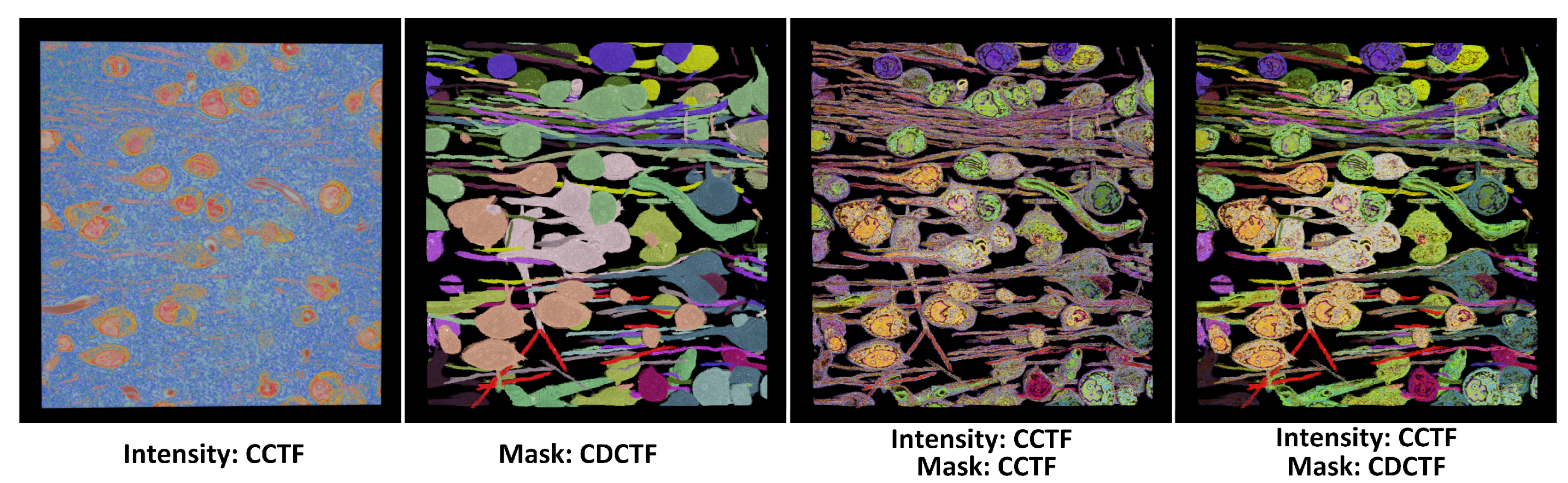 Jimaging 11 00193 g006