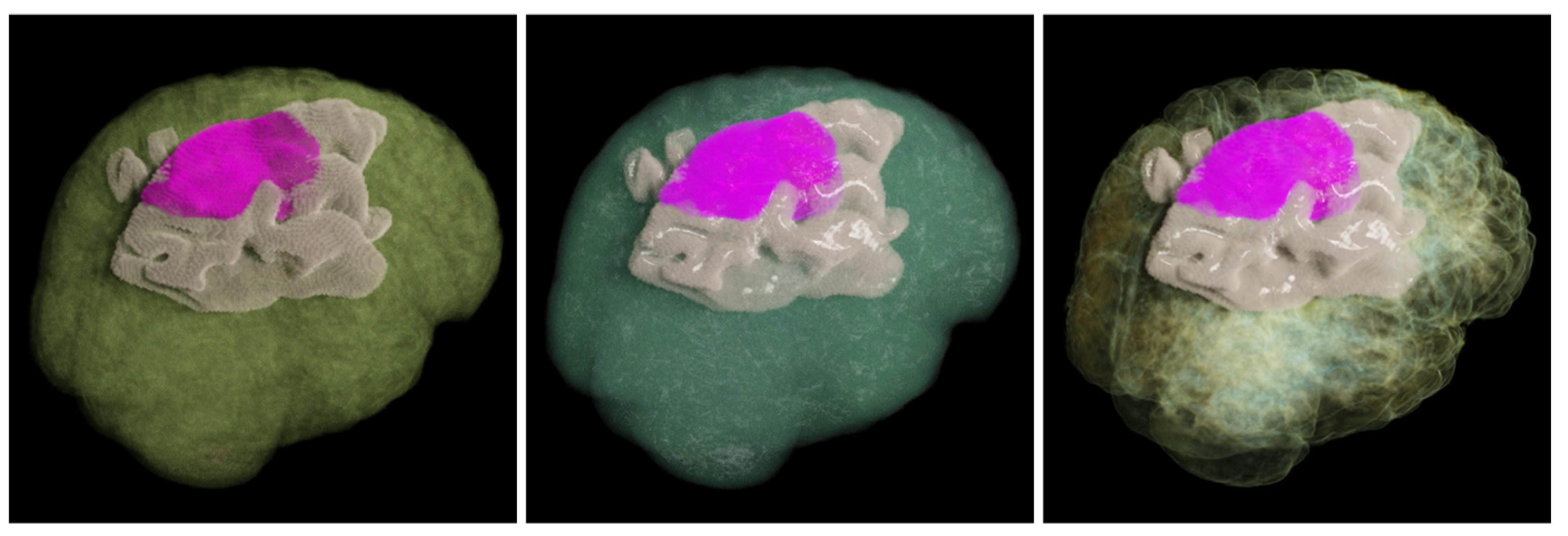 Jimaging 11 00193 g007