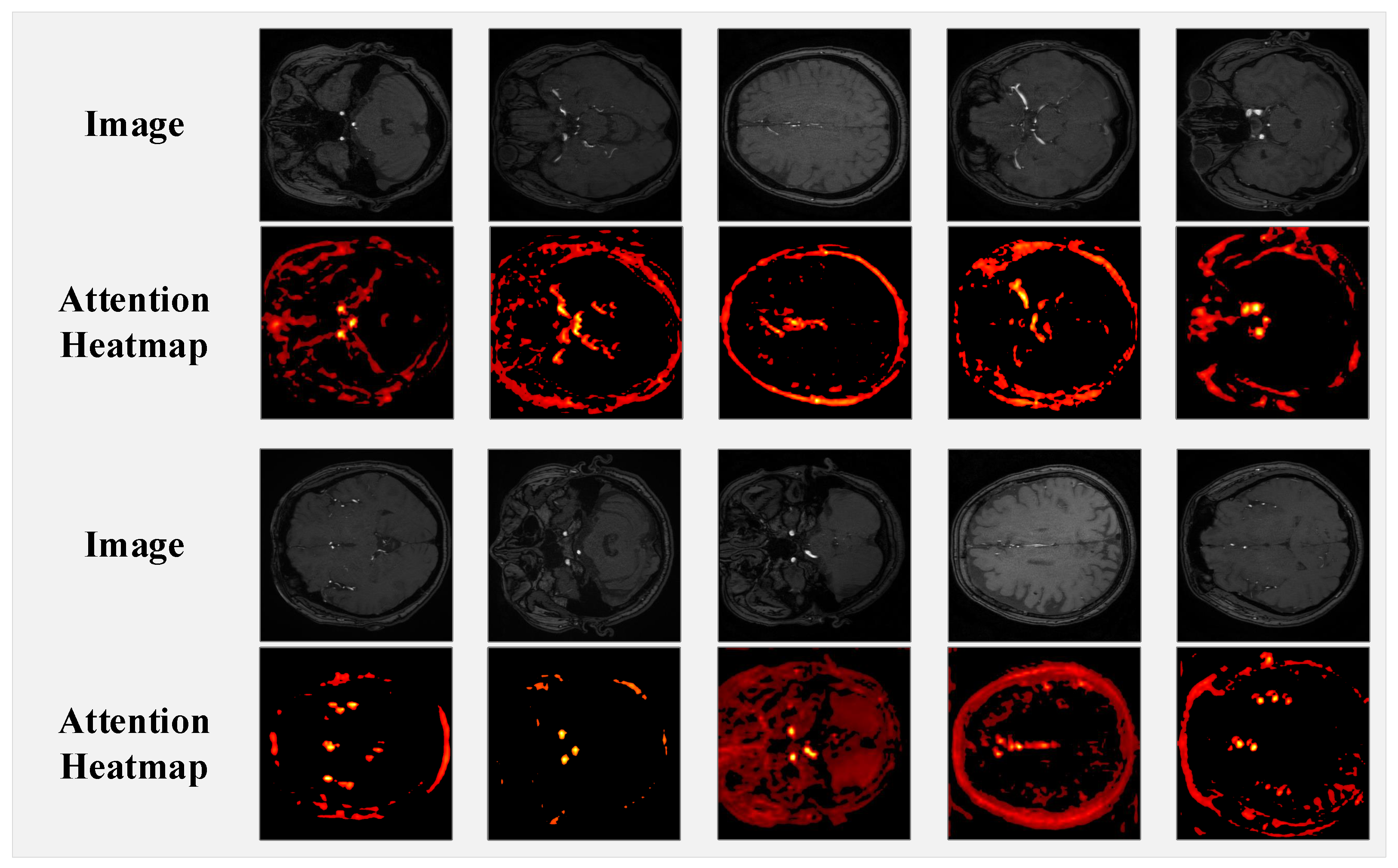 Jimaging 11 00202 g008