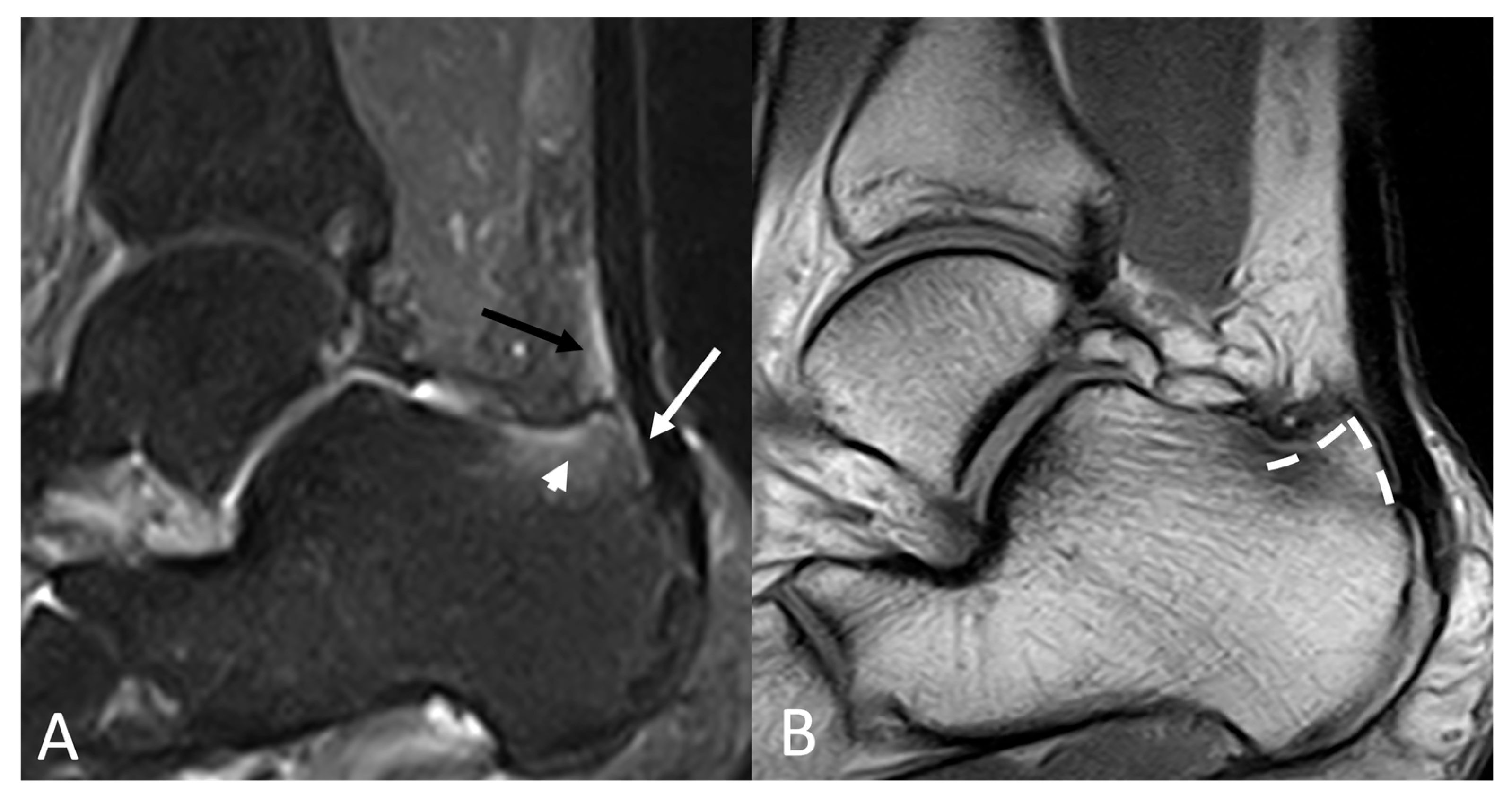 Jimaging 11 00217 g008