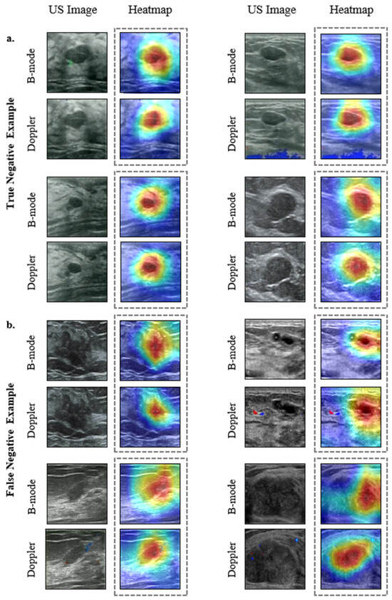 Jimaging 11 00240 g0a4