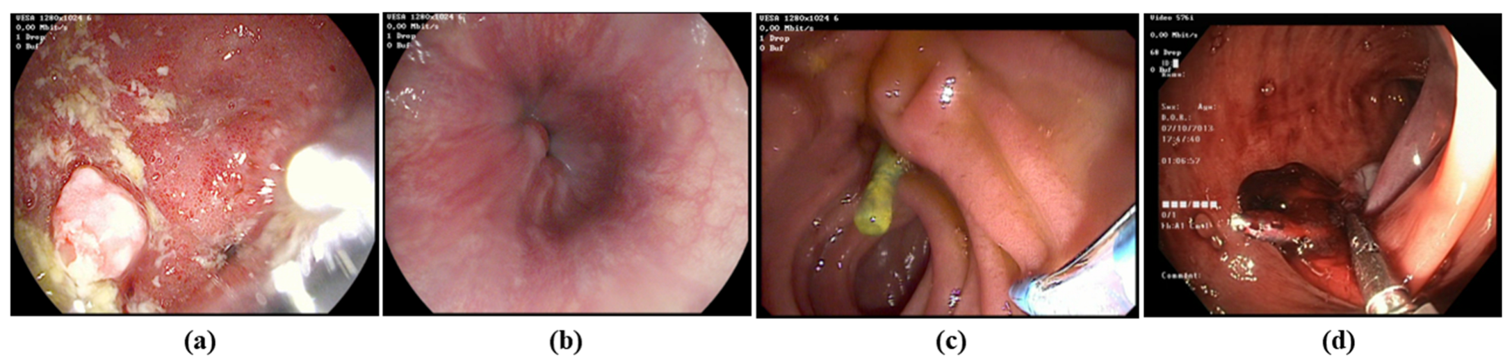 Jimaging 11 00243 g003