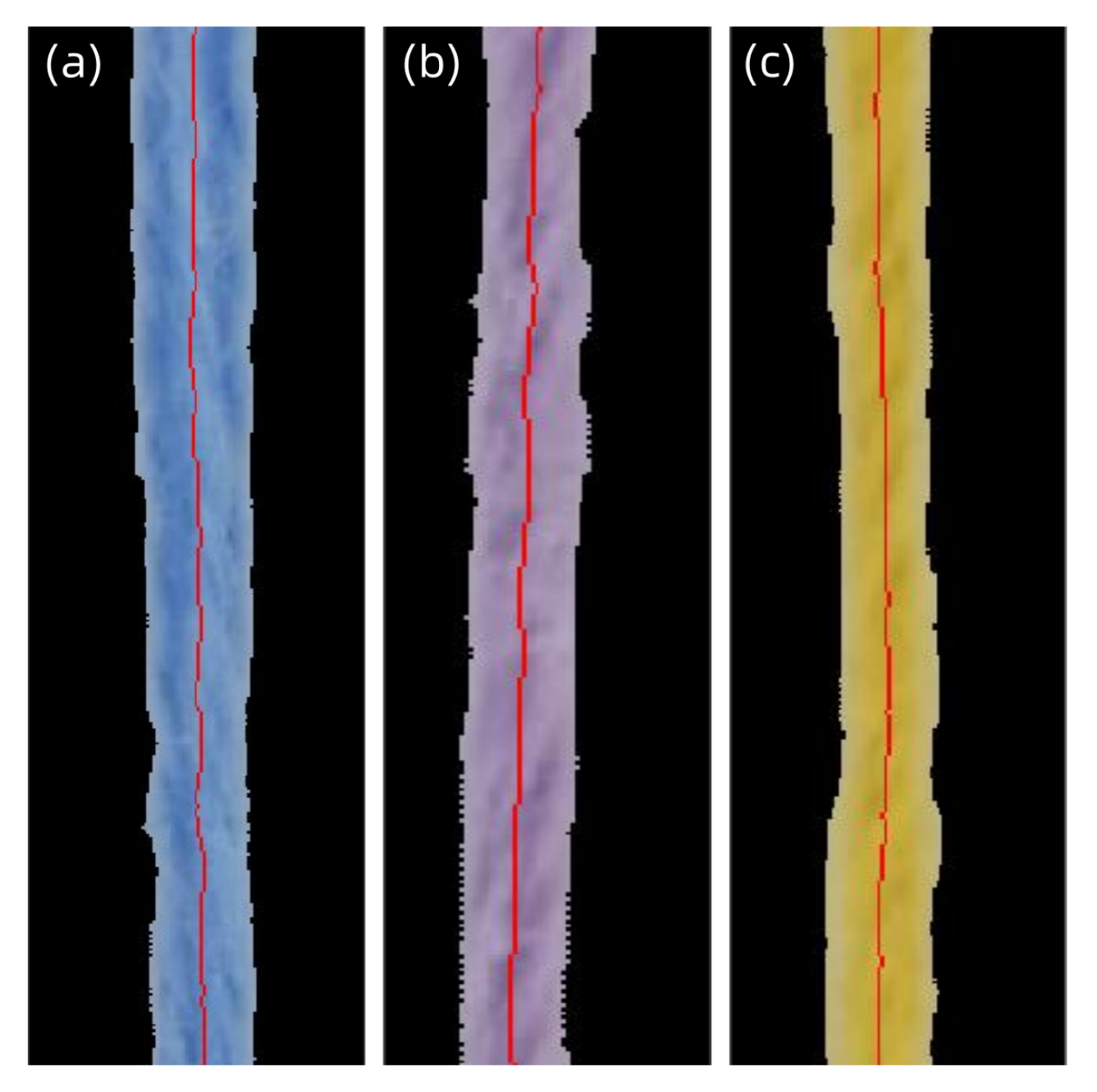 Jimaging 11 00248 g003
