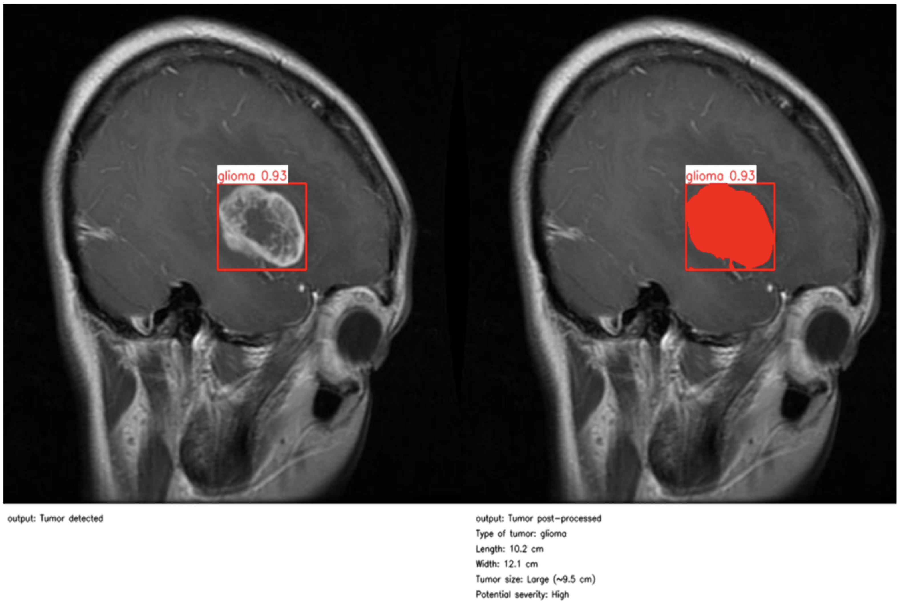 Jimaging 11 00282 g005