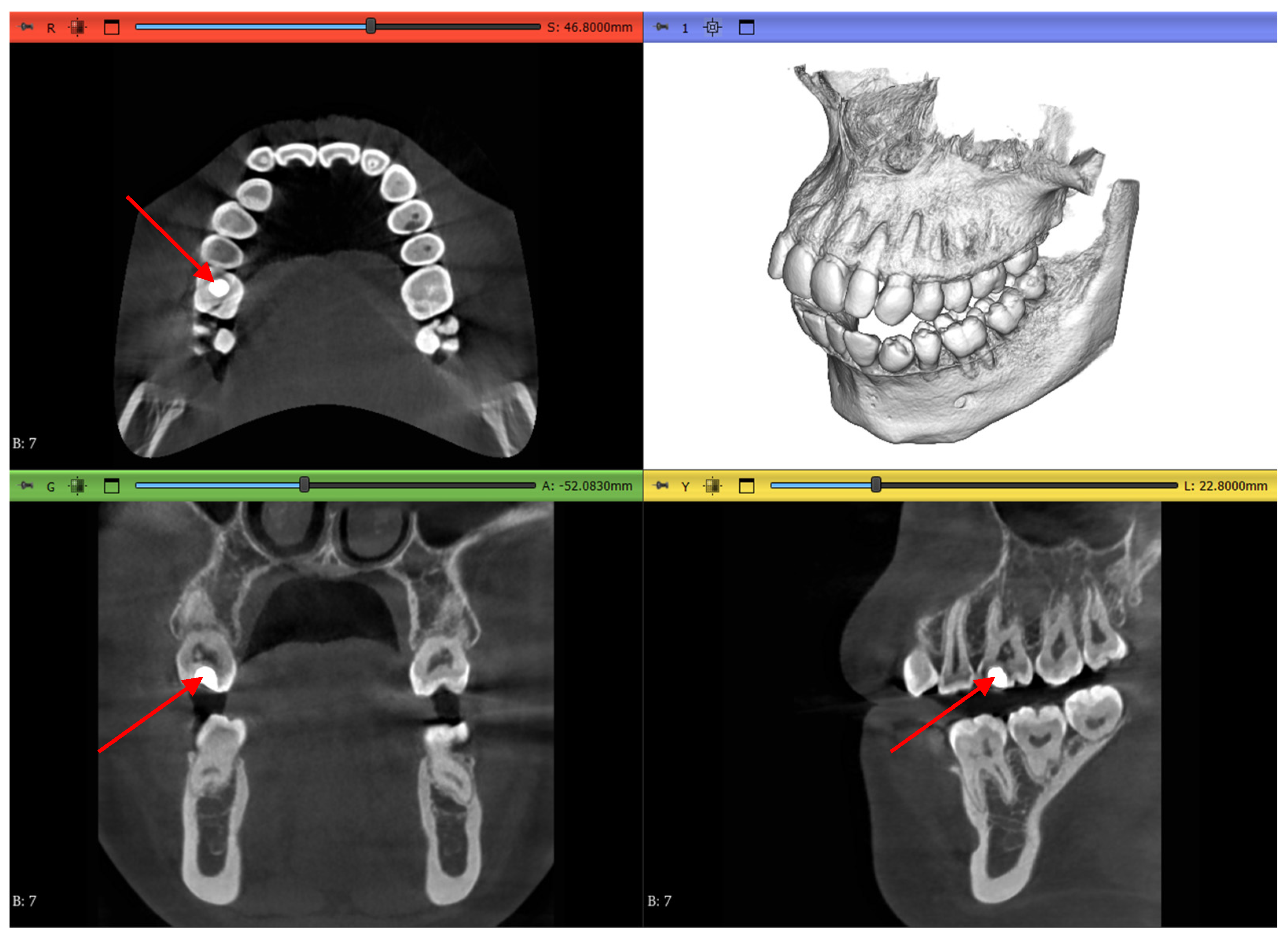 Jimaging 11 00340 g004 Jimaging 11 00340 g004