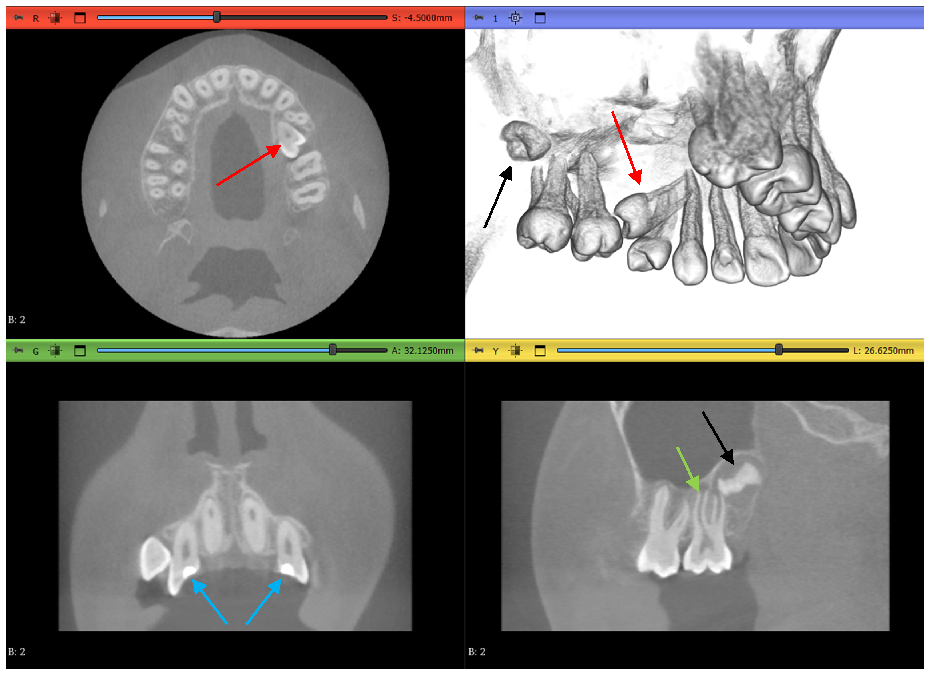 Jimaging 11 00340 g005 Jimaging 11 00340 g005