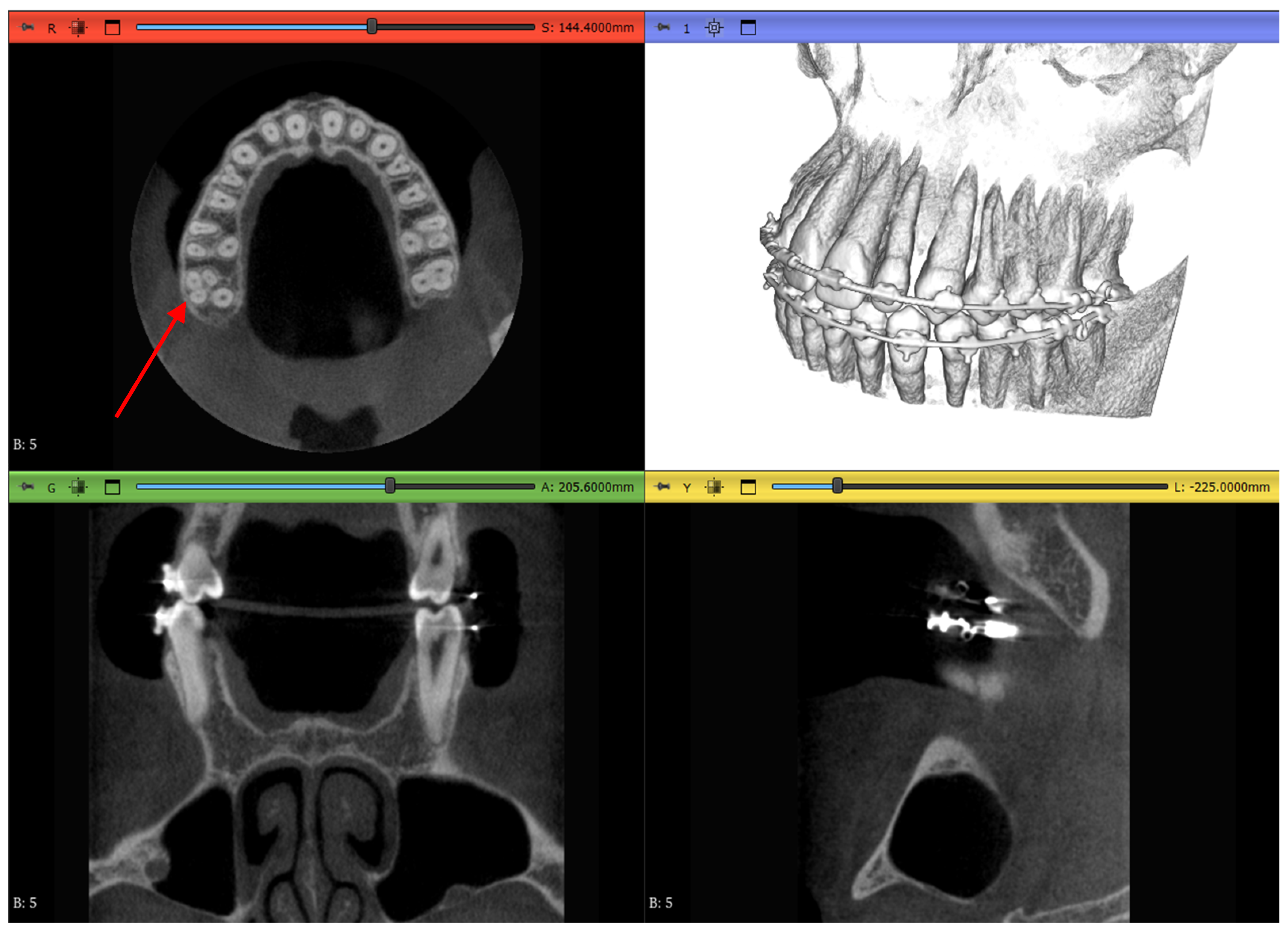 Jimaging 11 00340 g006 Jimaging 11 00340 g006