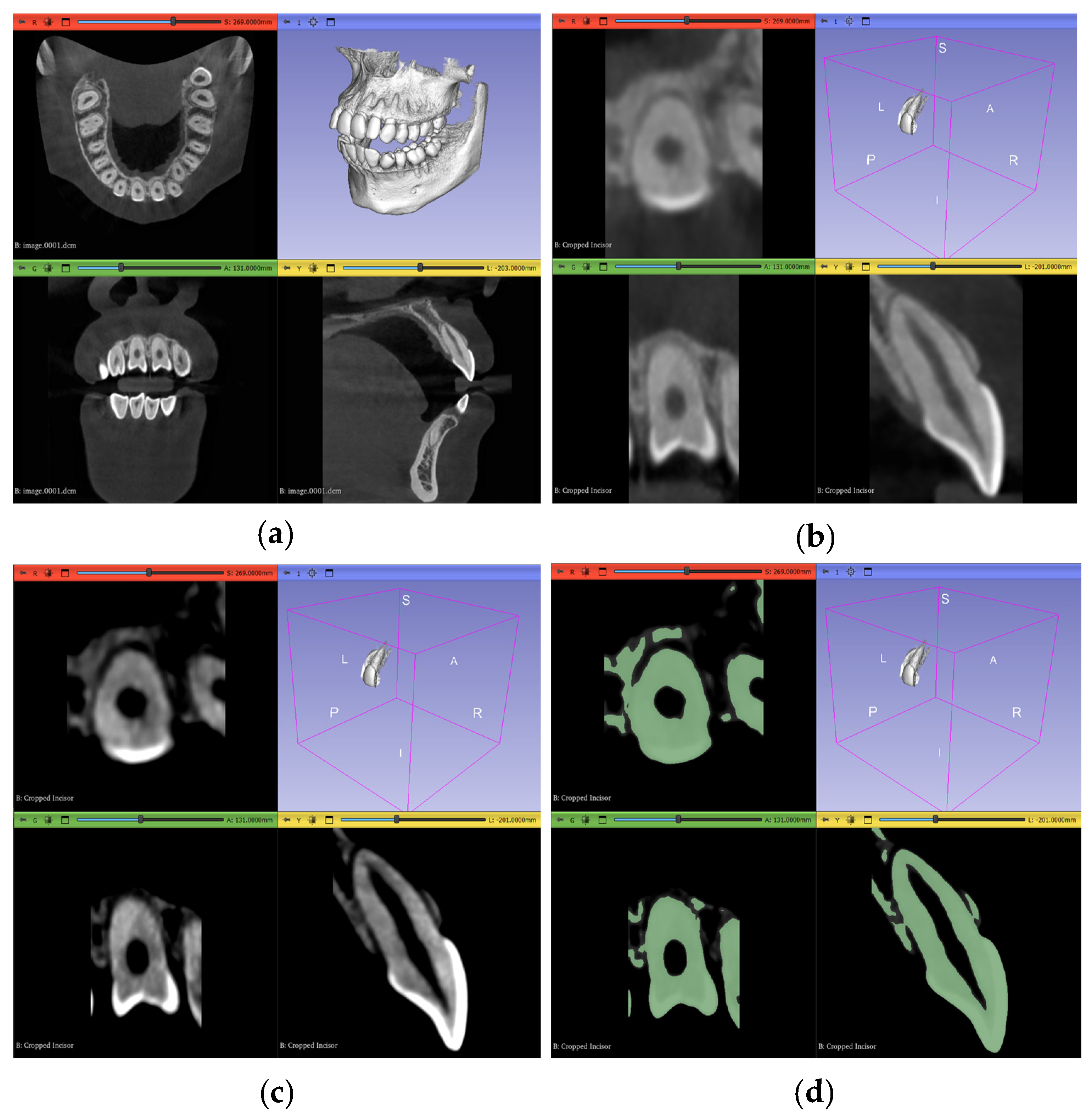 Jimaging 11 00340 g007 Jimaging 11 00340 g007