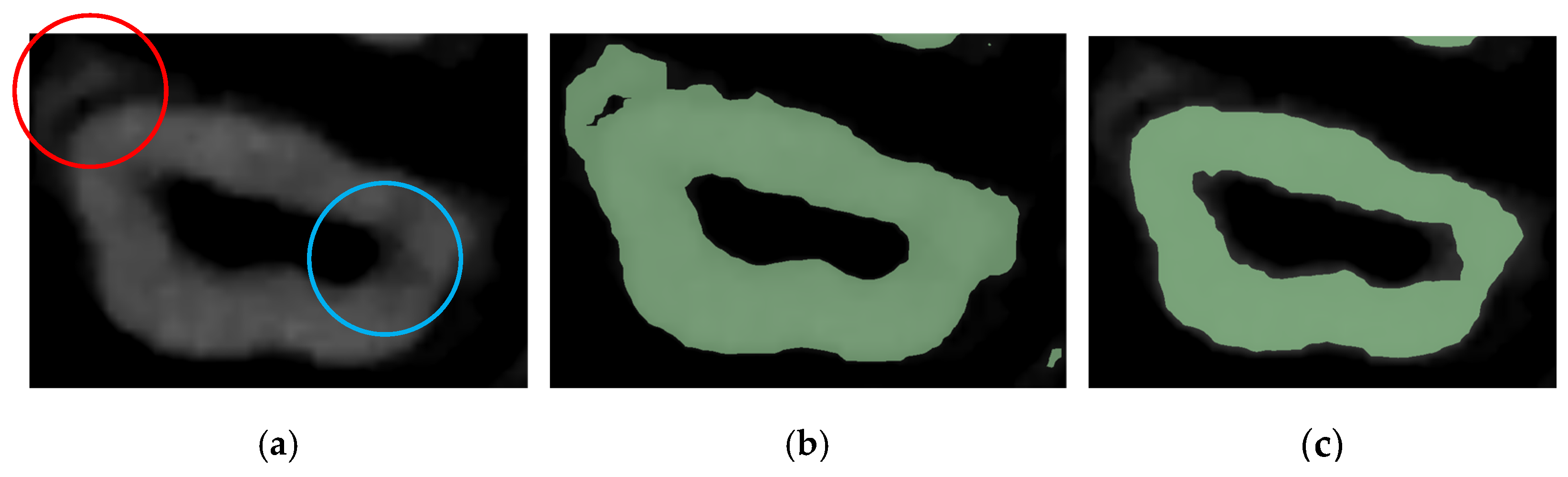 Jimaging 11 00340 g009 Jimaging 11 00340 g009