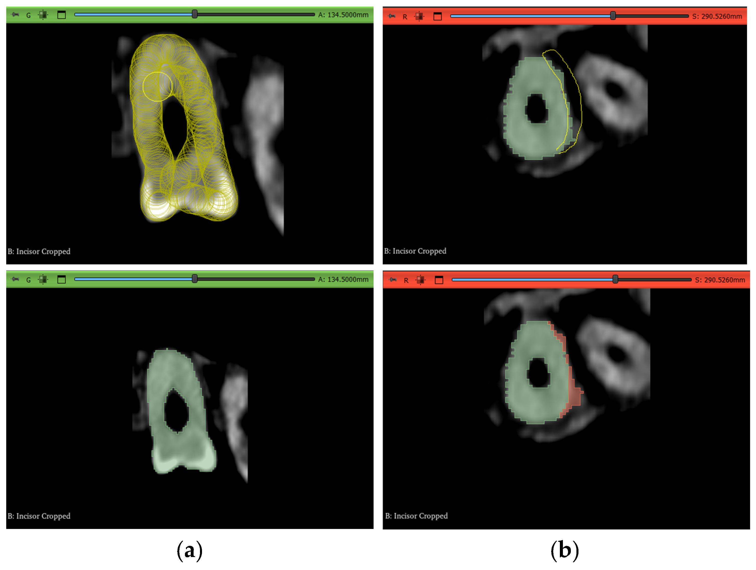 Jimaging 11 00340 g010 Jimaging 11 00340 g010