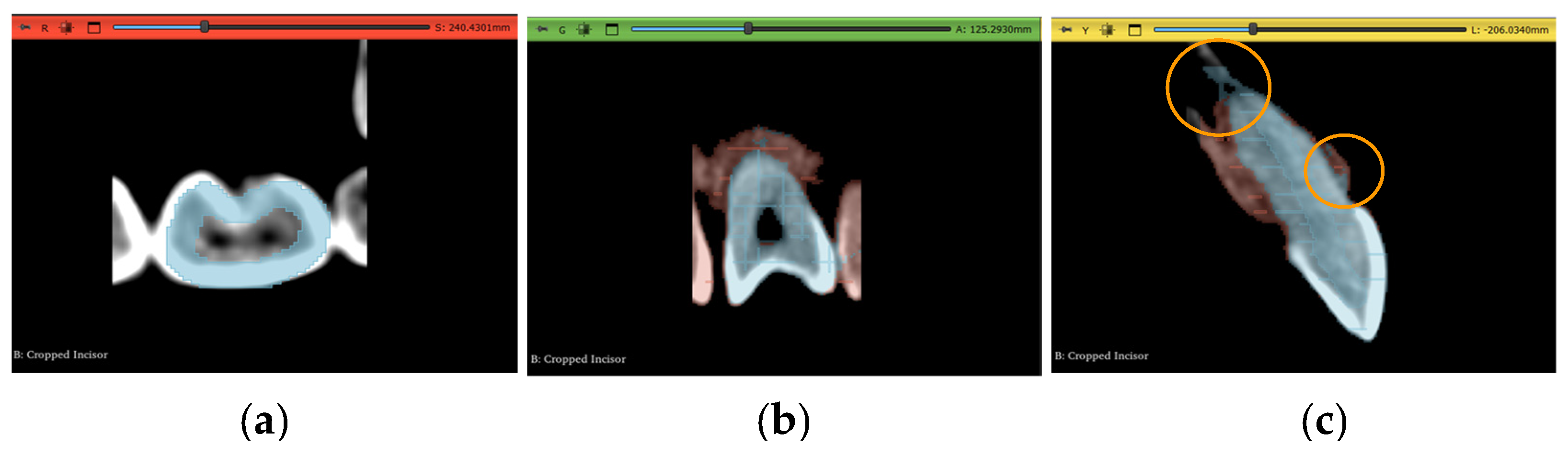 Jimaging 11 00340 g011 Jimaging 11 00340 g011