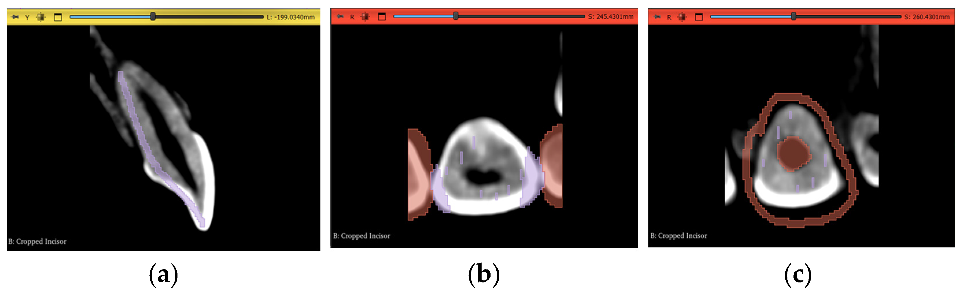 Jimaging 11 00340 g013 Jimaging 11 00340 g013