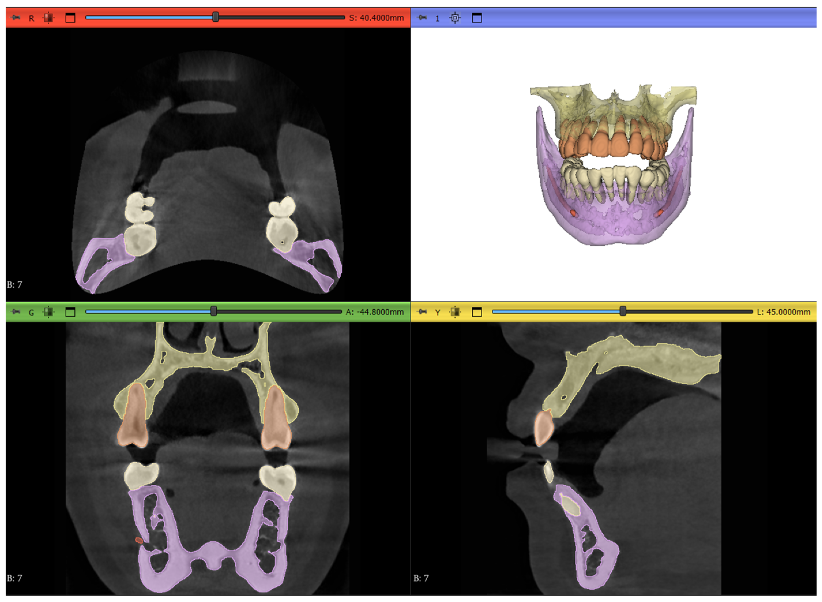 Jimaging 11 00340 g015 Jimaging 11 00340 g015