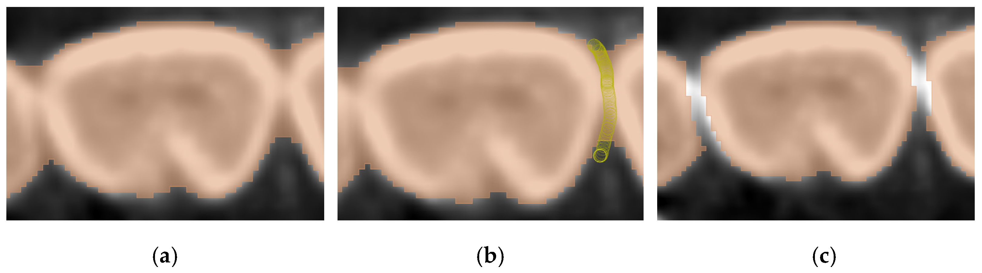 Jimaging 11 00340 g016 Jimaging 11 00340 g016
