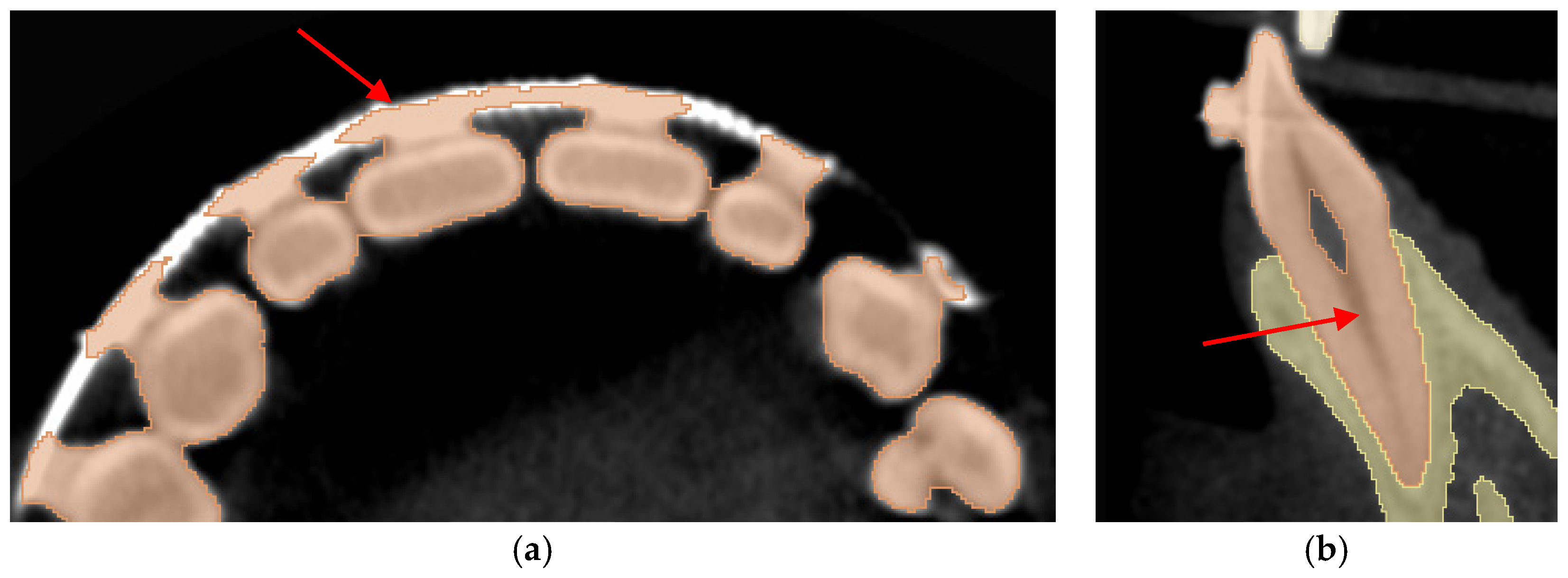 Jimaging 11 00340 g017 Jimaging 11 00340 g017