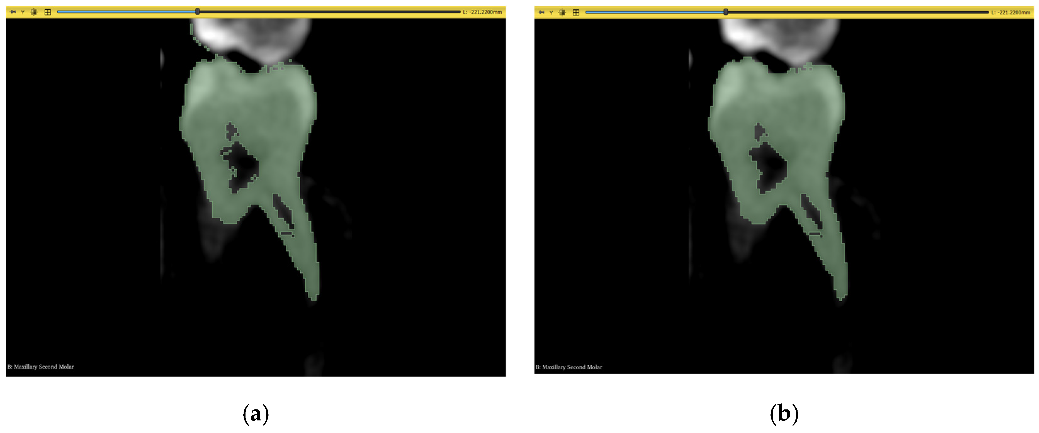 Jimaging 11 00340 g018 Jimaging 11 00340 g018