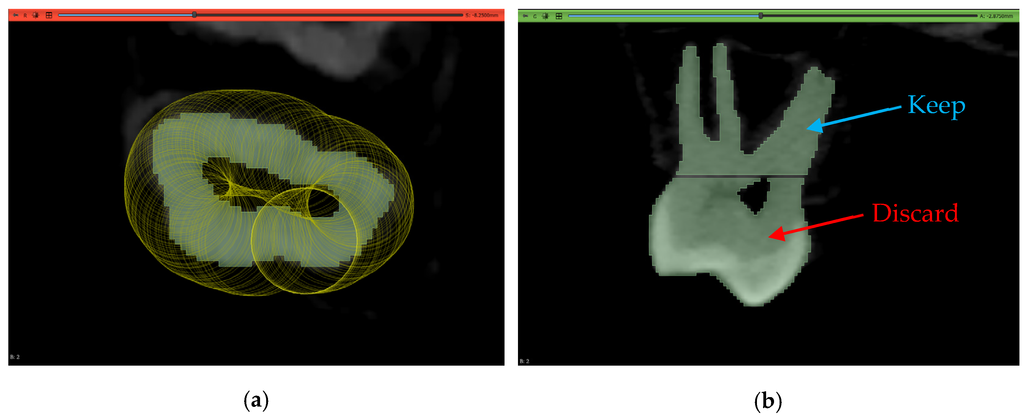 Jimaging 11 00340 g020 Jimaging 11 00340 g020